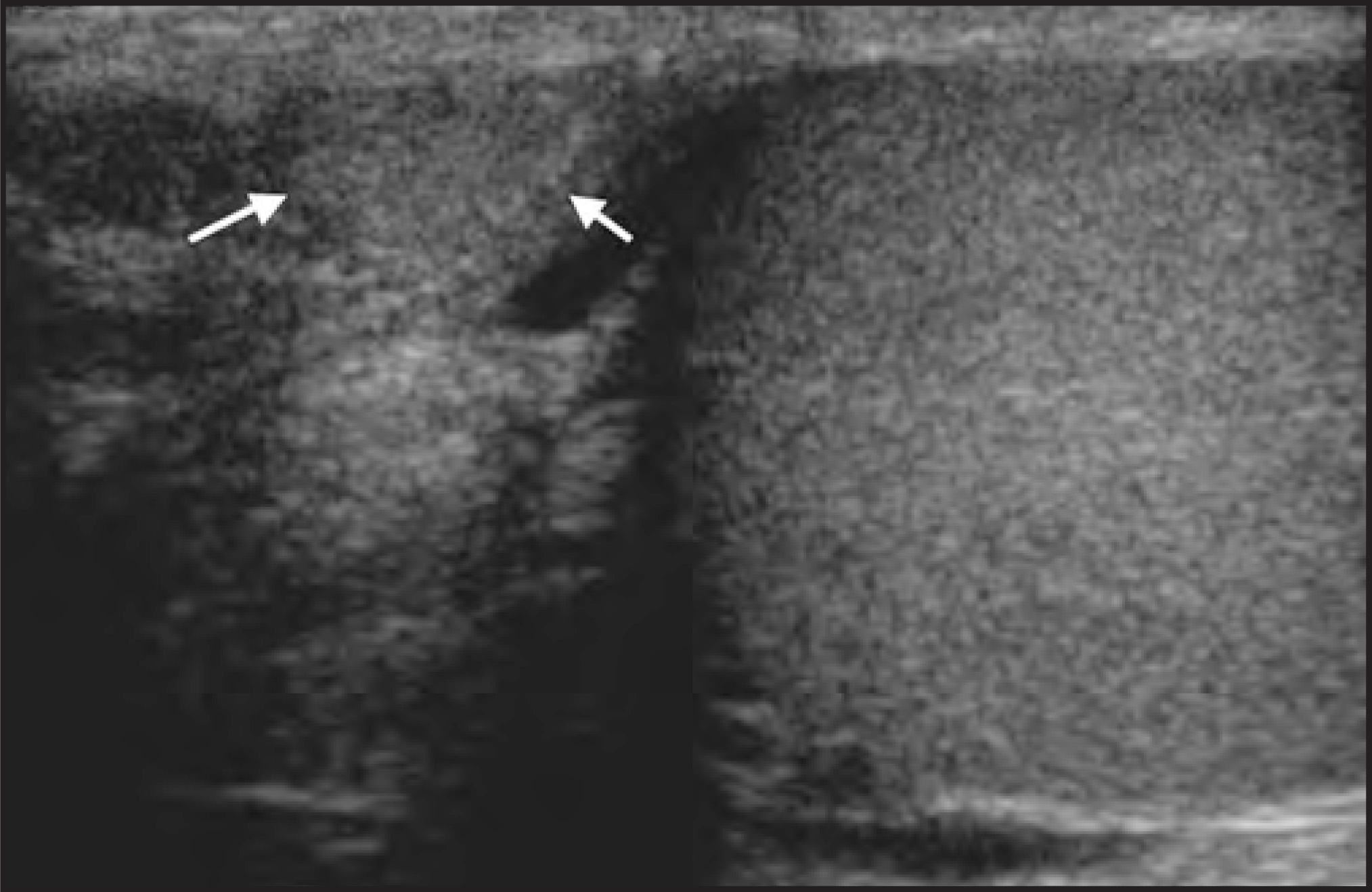 FIGURE 14.