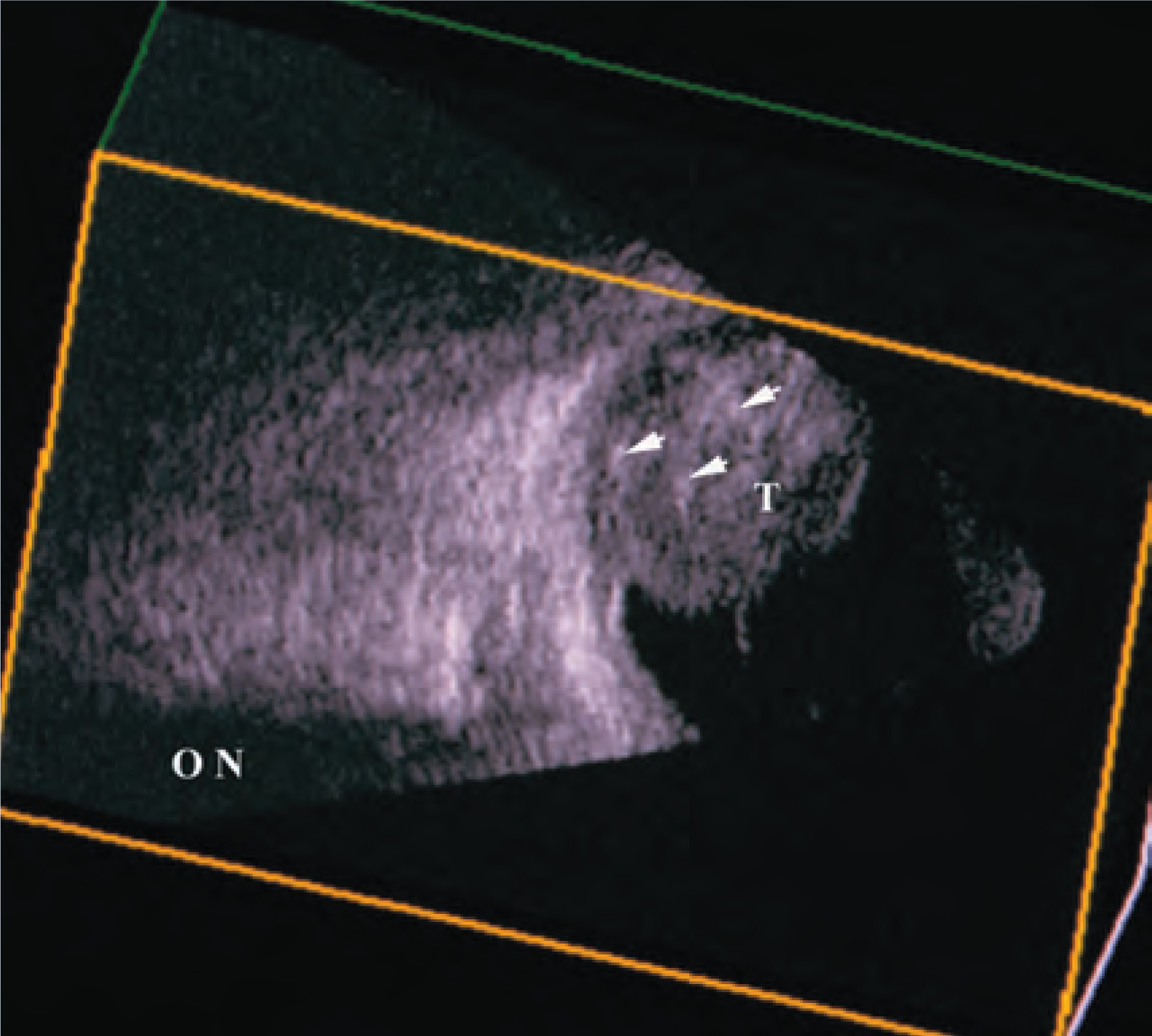 FIGURE 8.