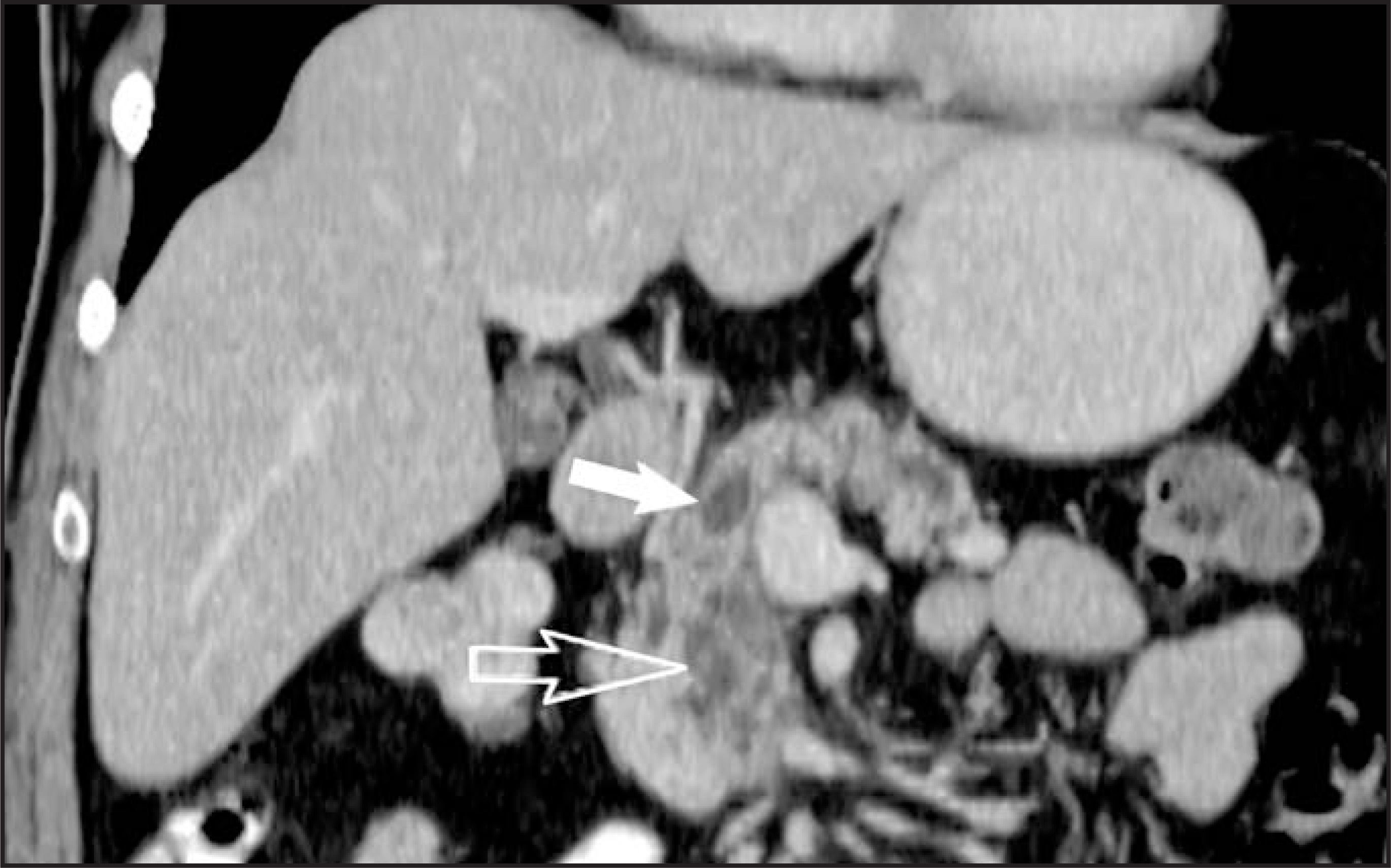FIGURE 13.