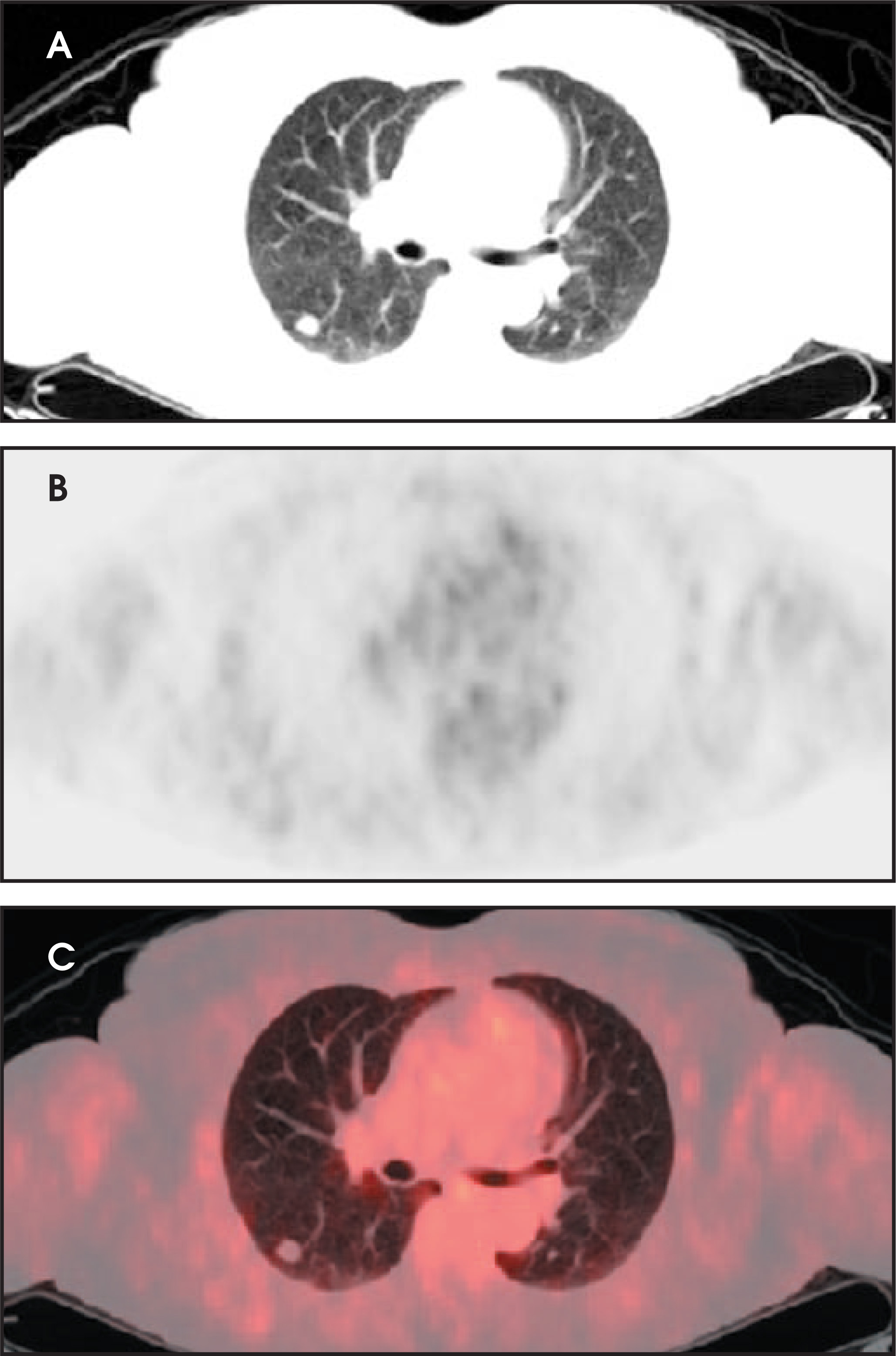 FIGURE 11.