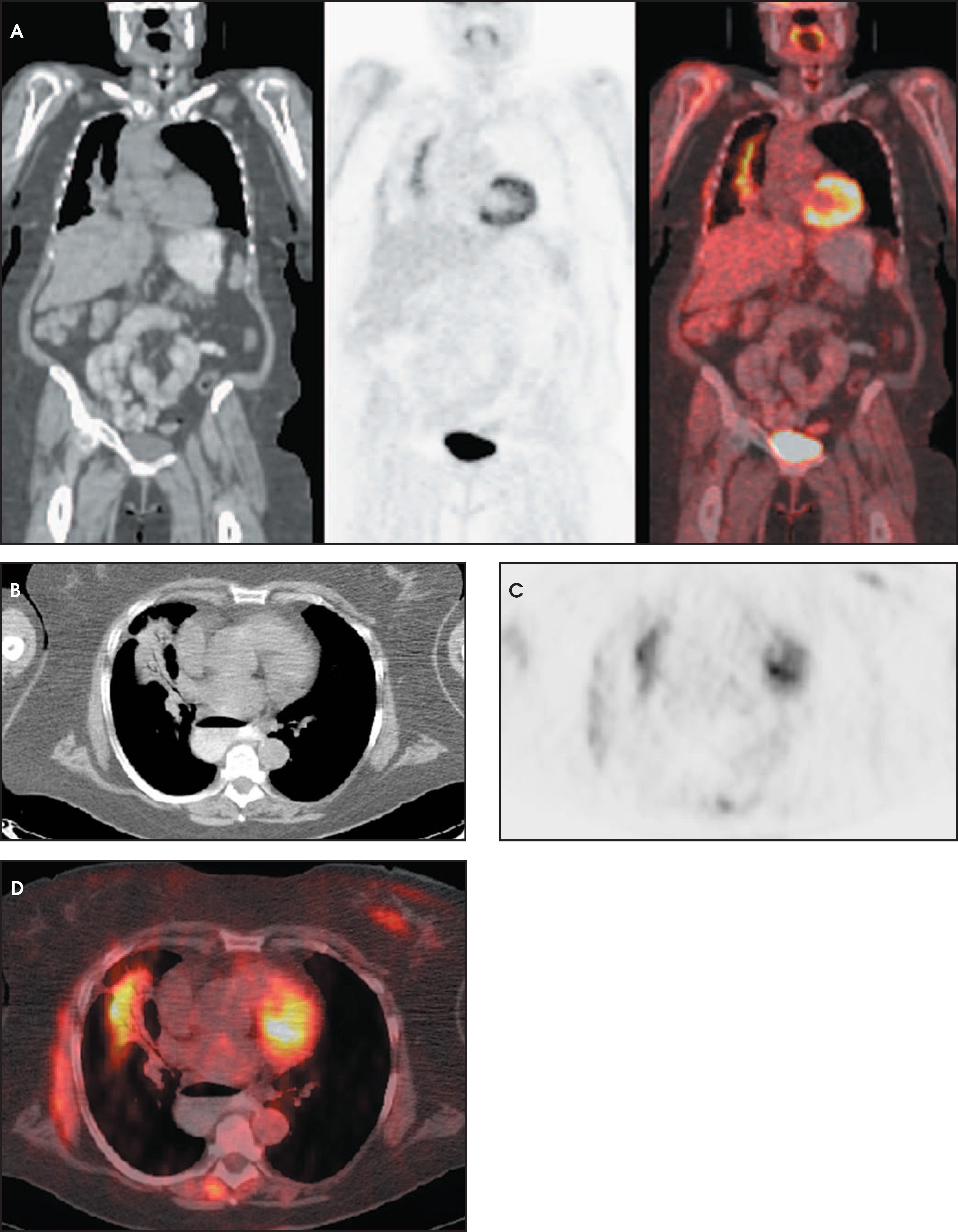 FIGURE 14.