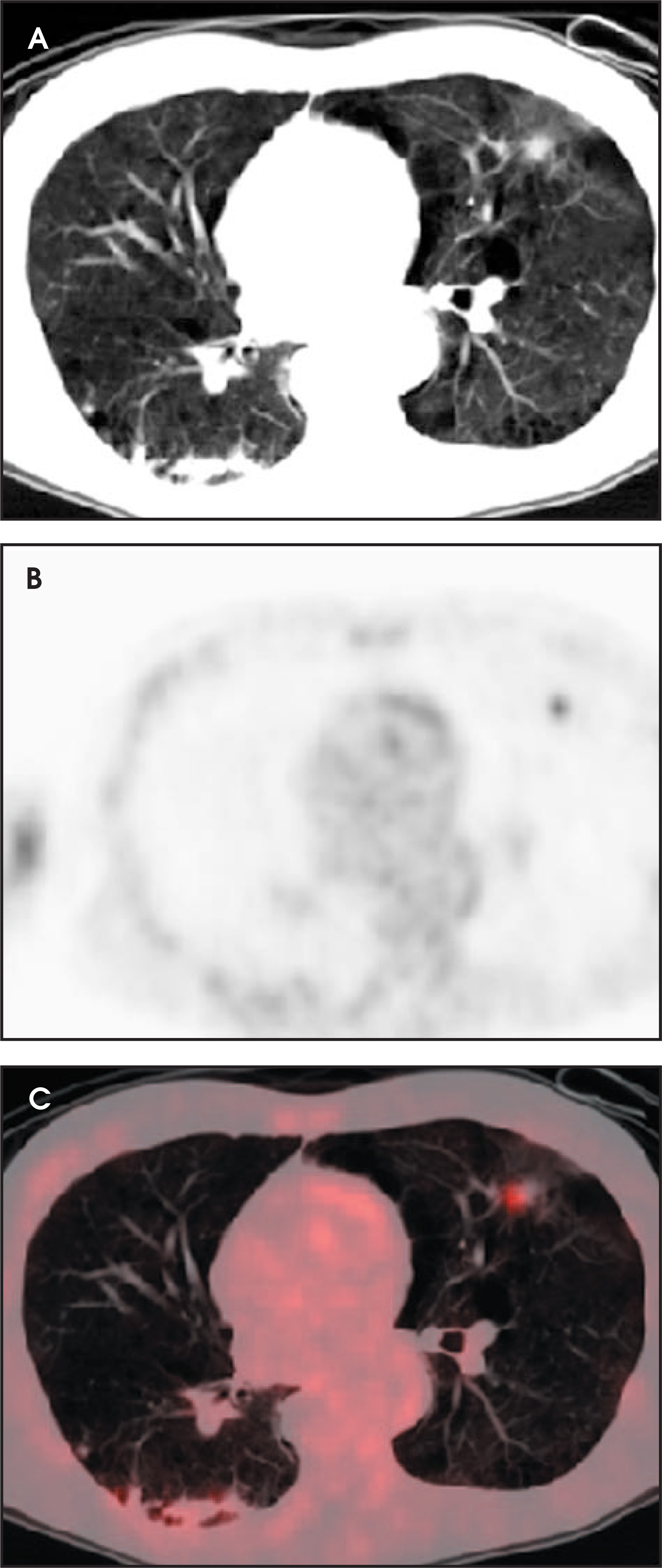 FIGURE 17.