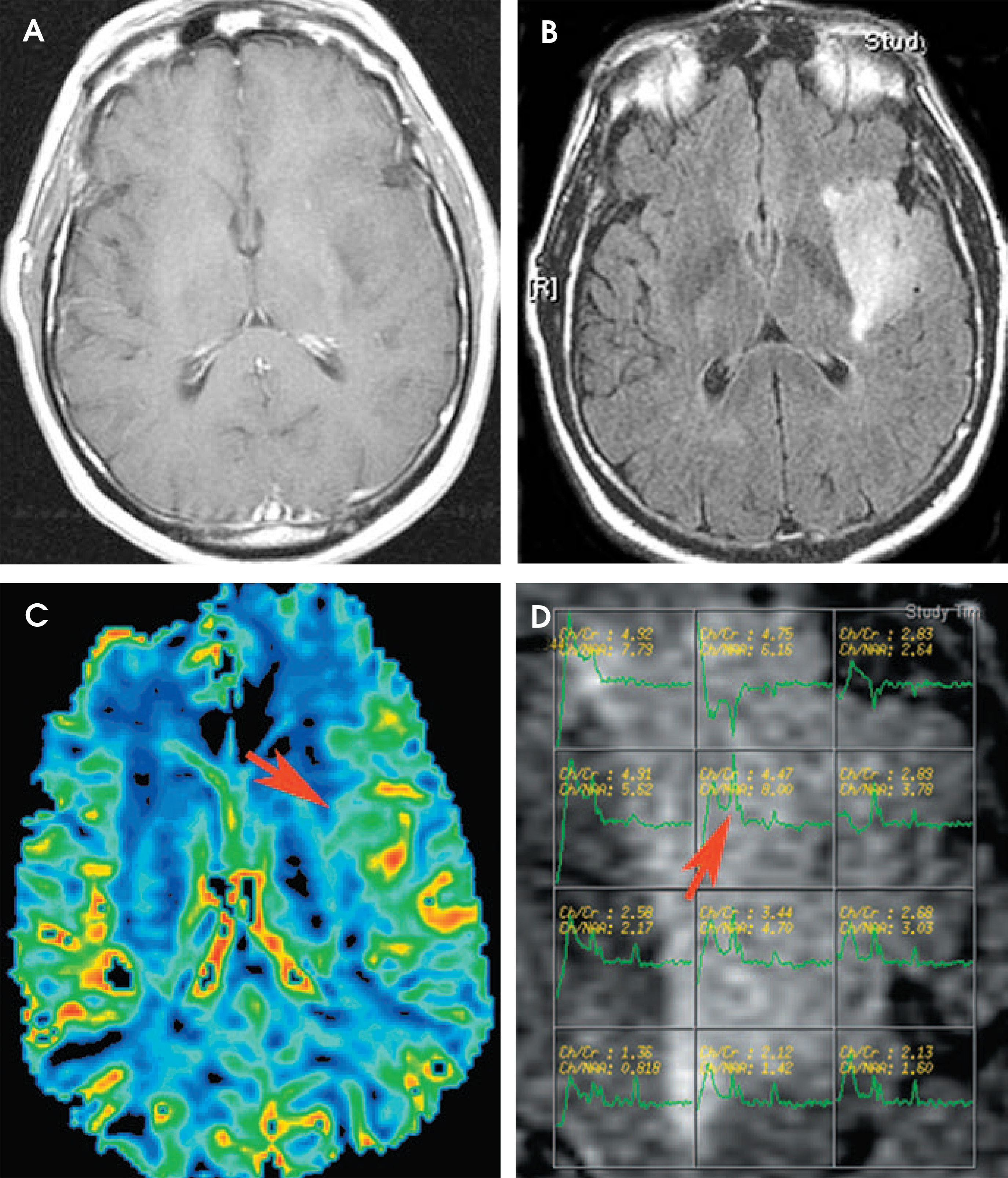 FIGURE 3.