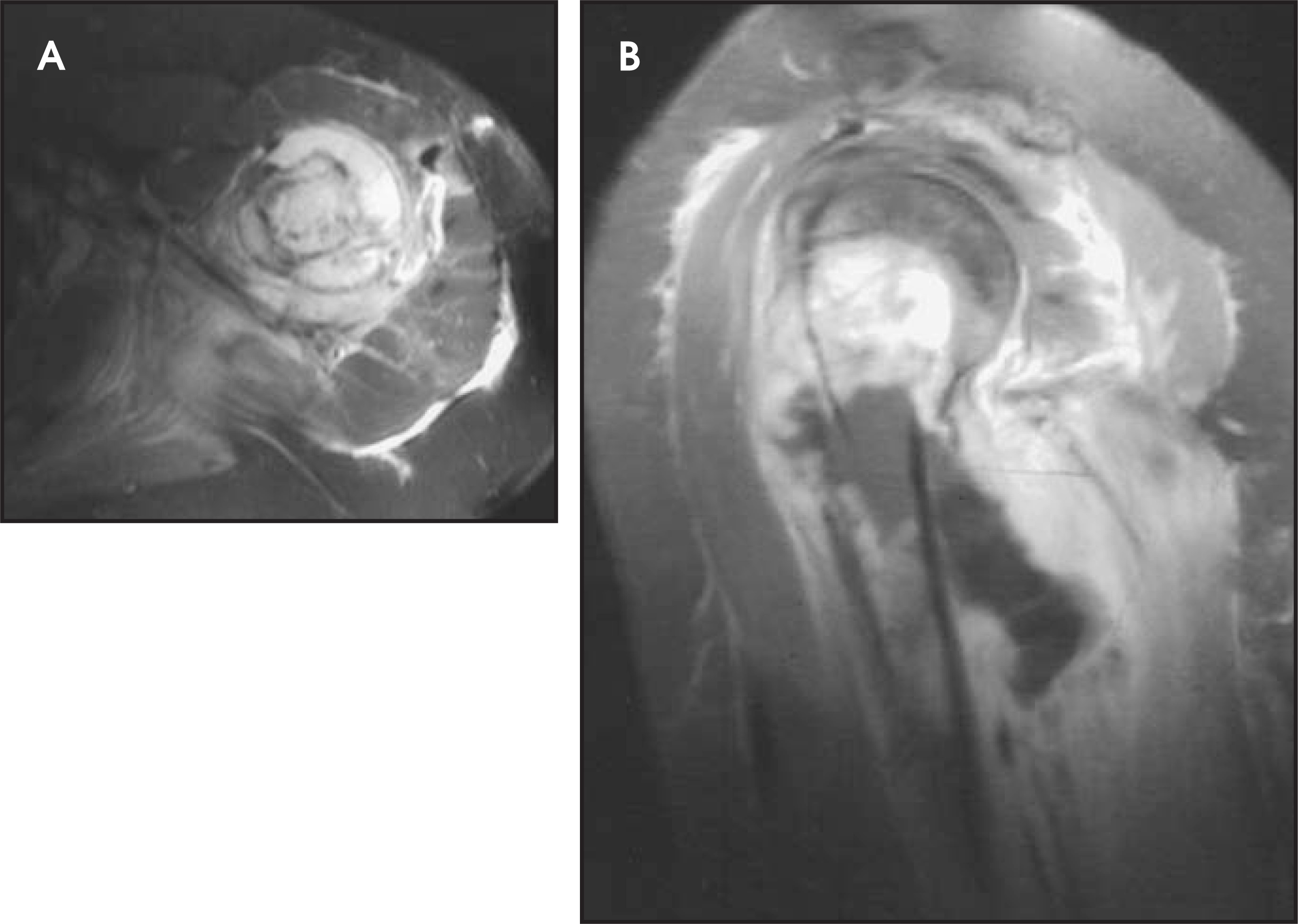 FIGURE 11.