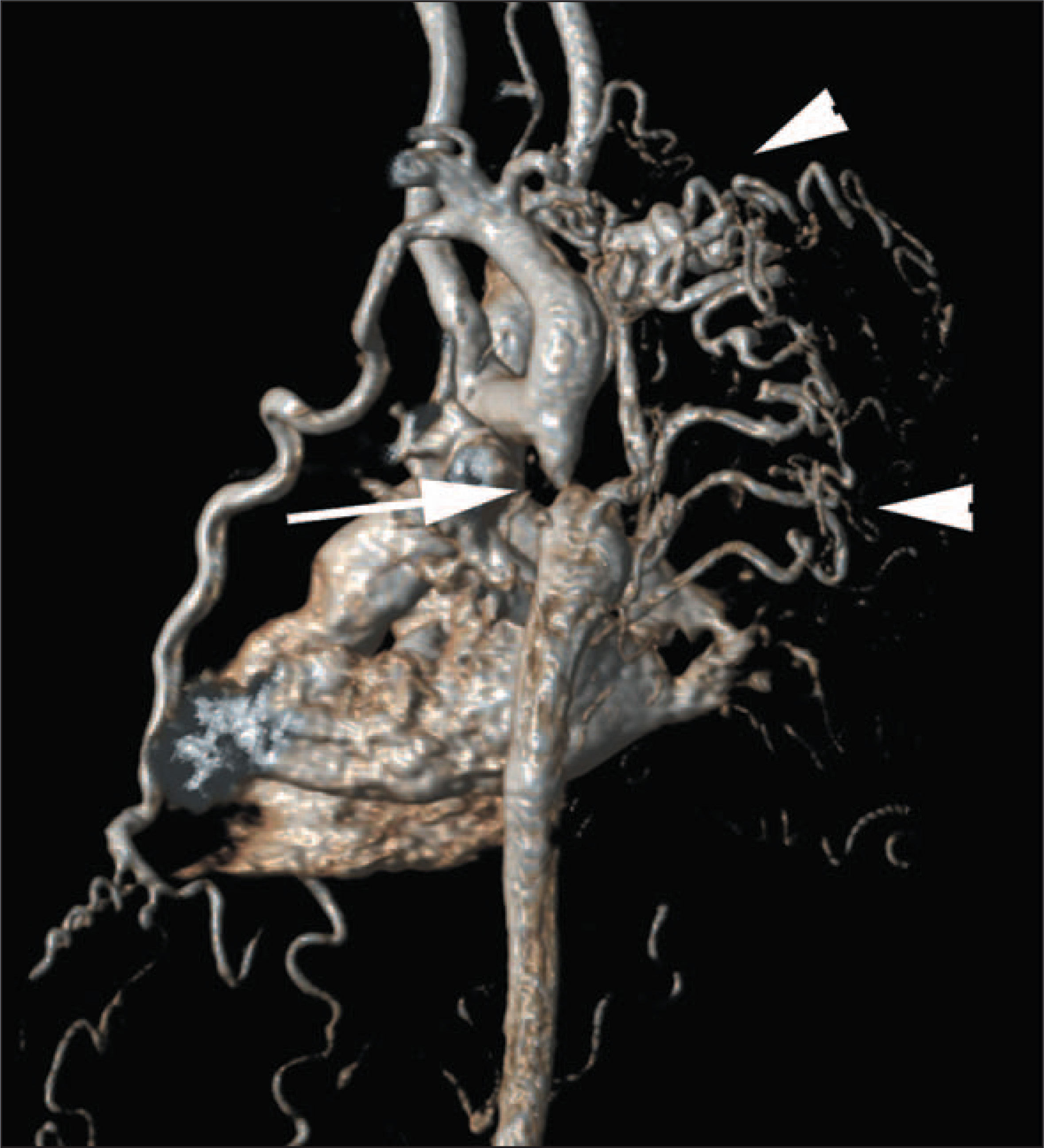 FIGURE 4.