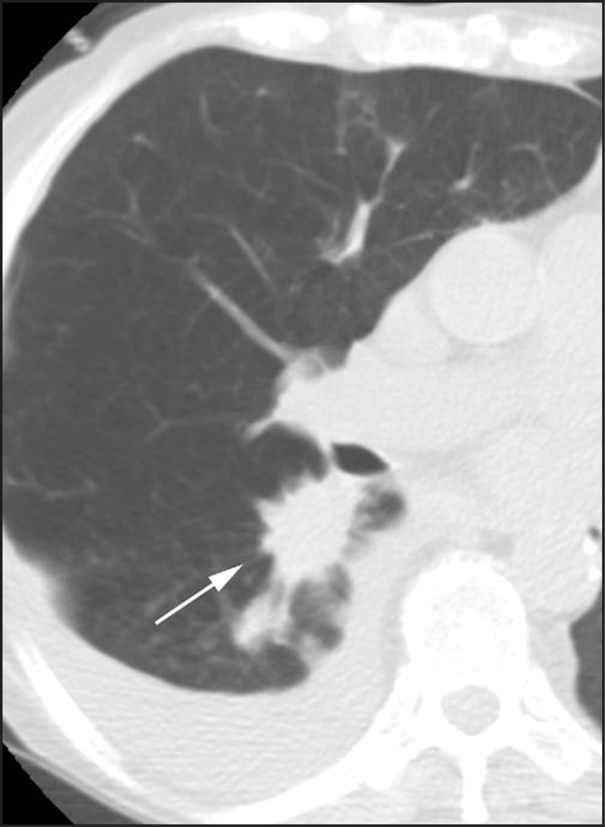 FIGURE 10.