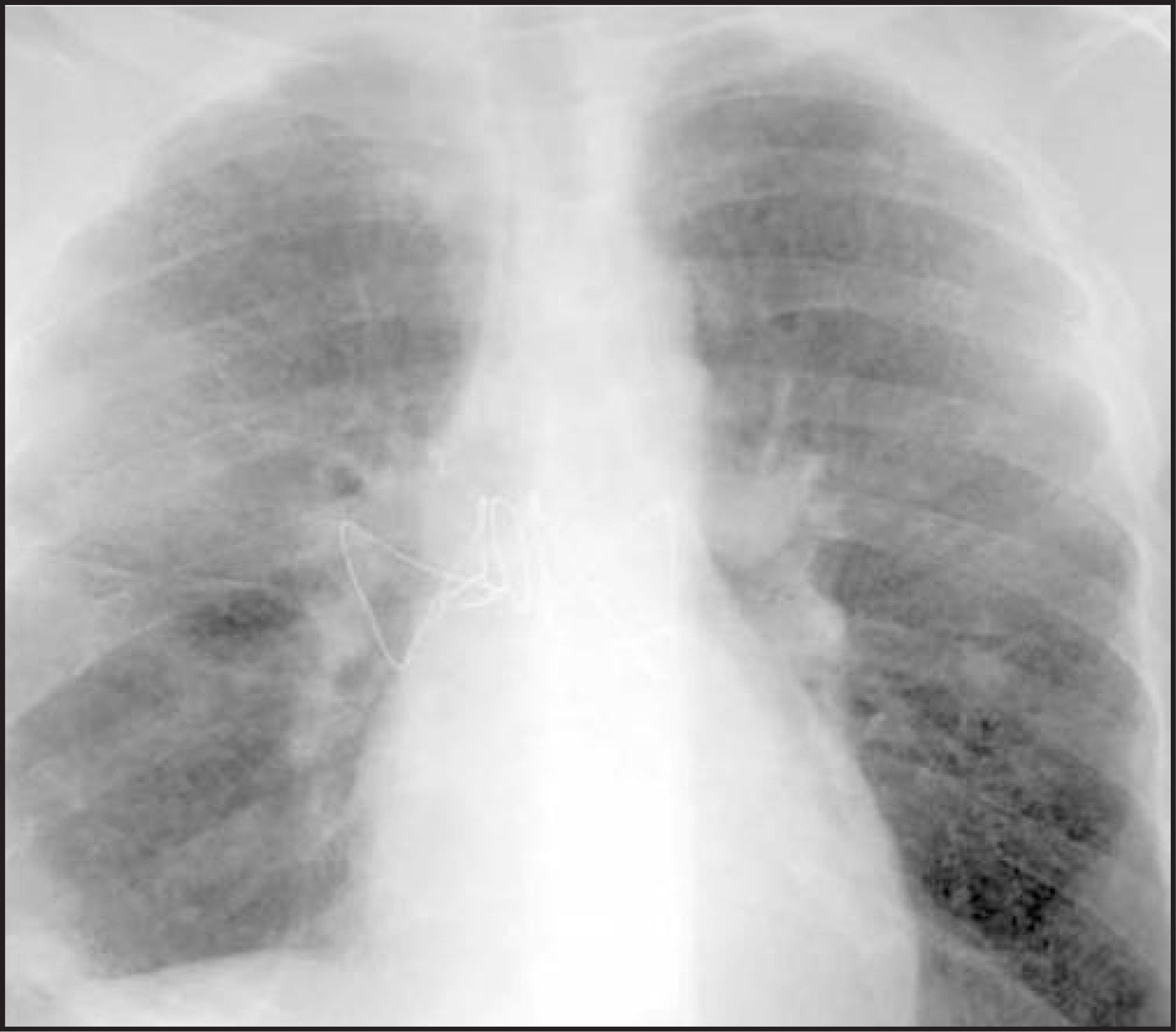 FIGURE 11.
