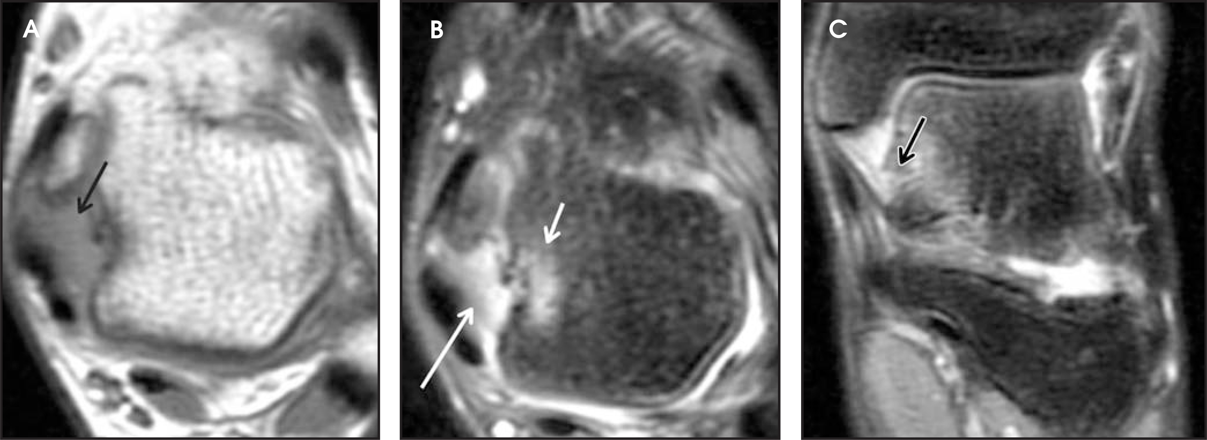 FIGURE 11.