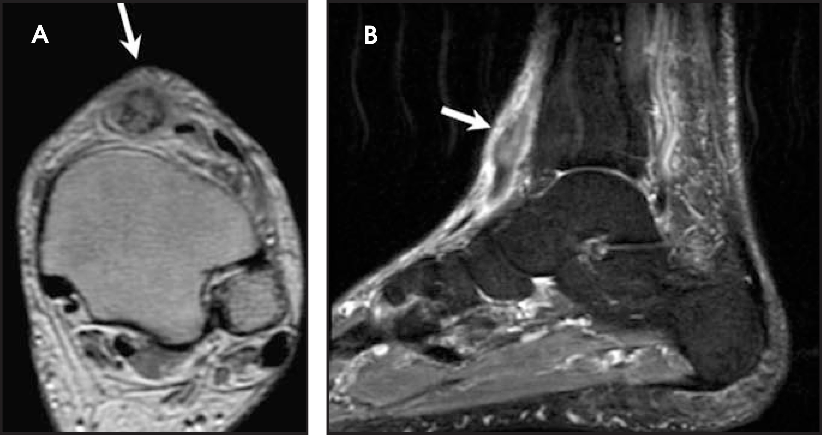 FIGURE 14.