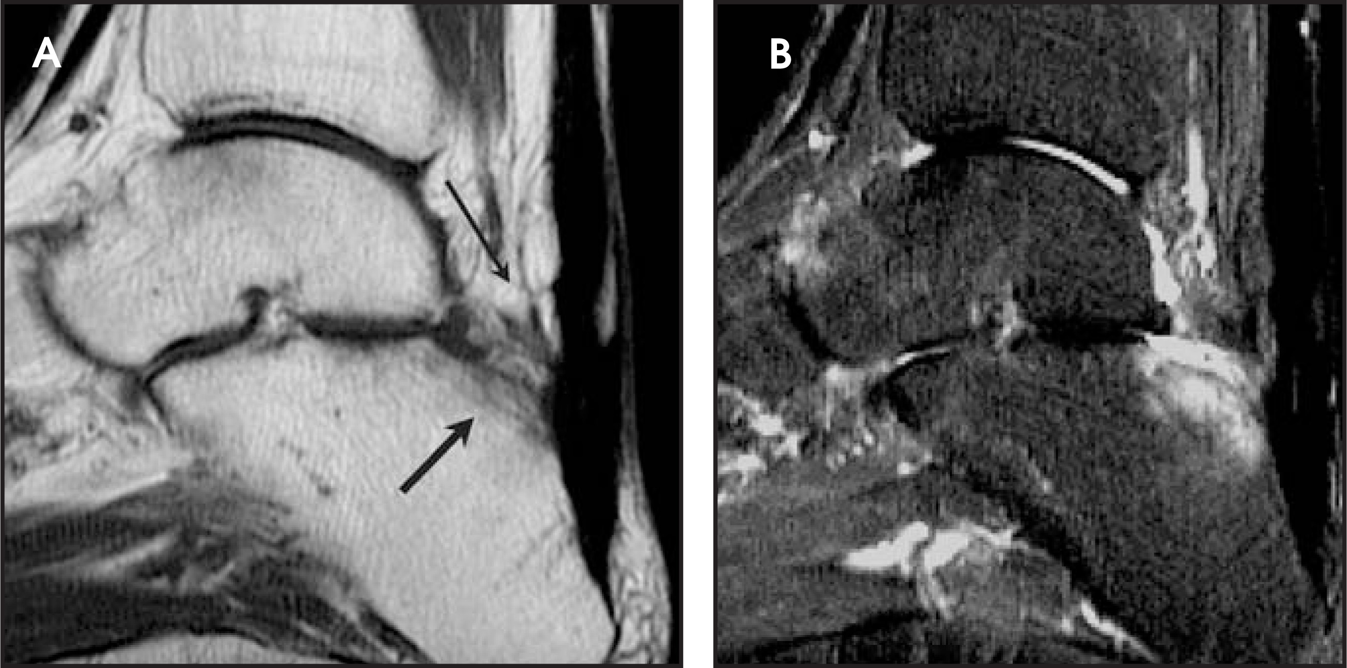 FIGURE 16.