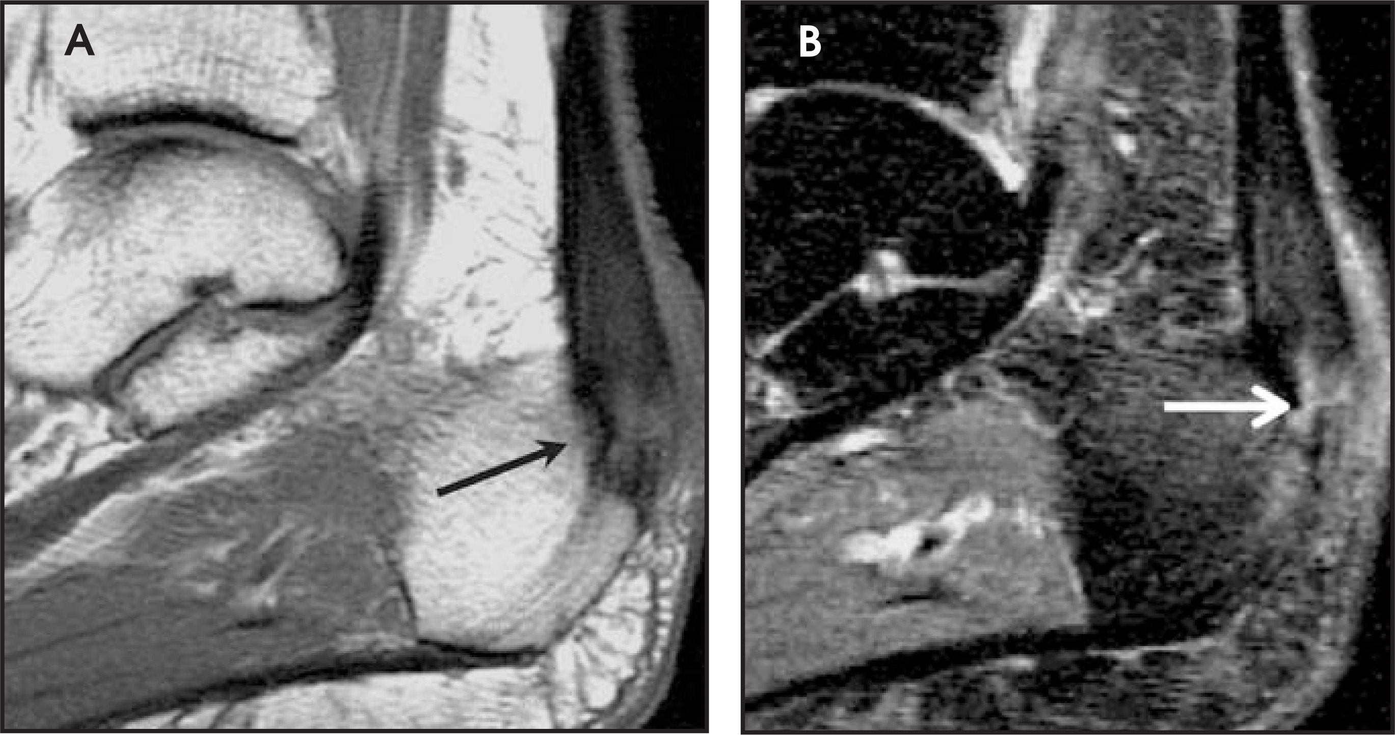FIGURE 17.