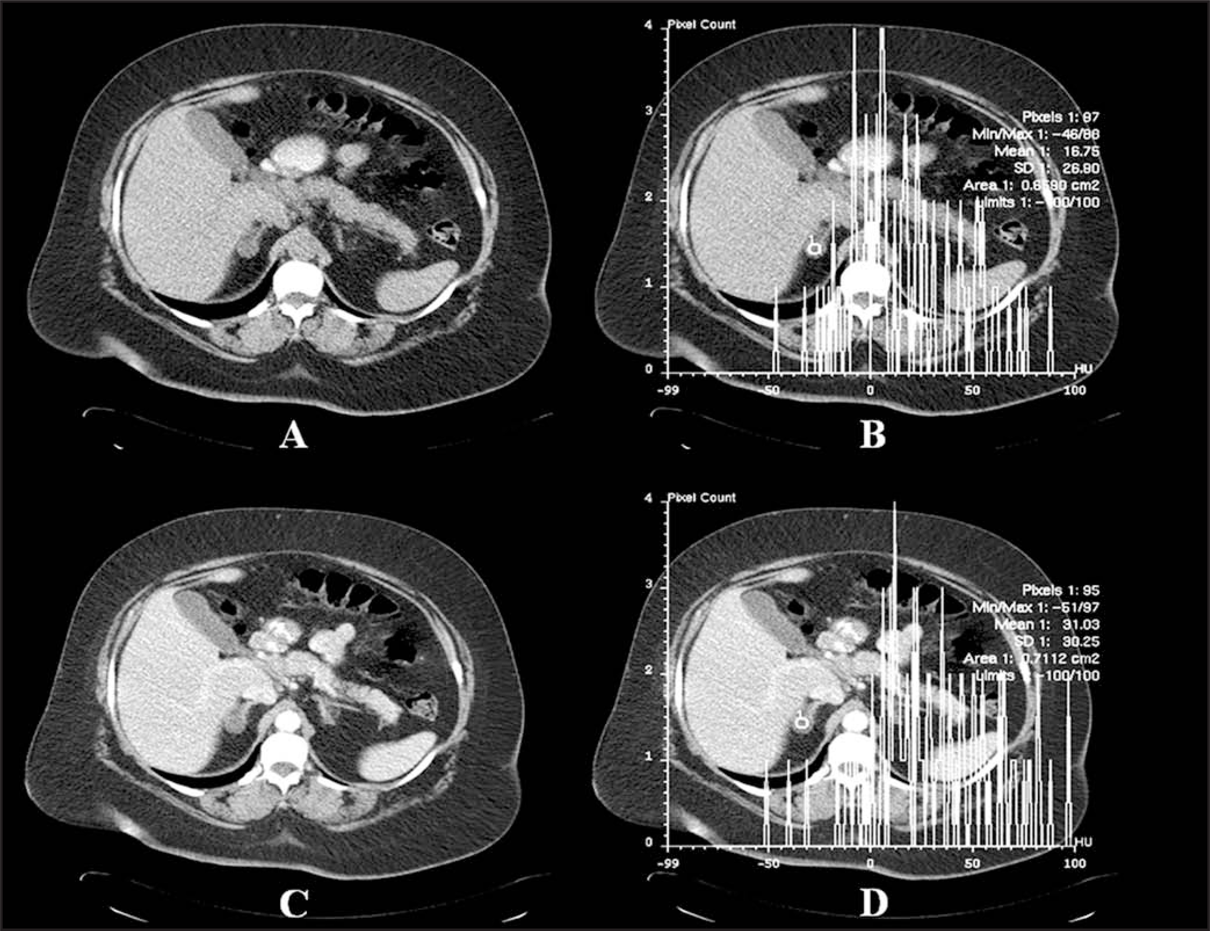 FIGURE 11.