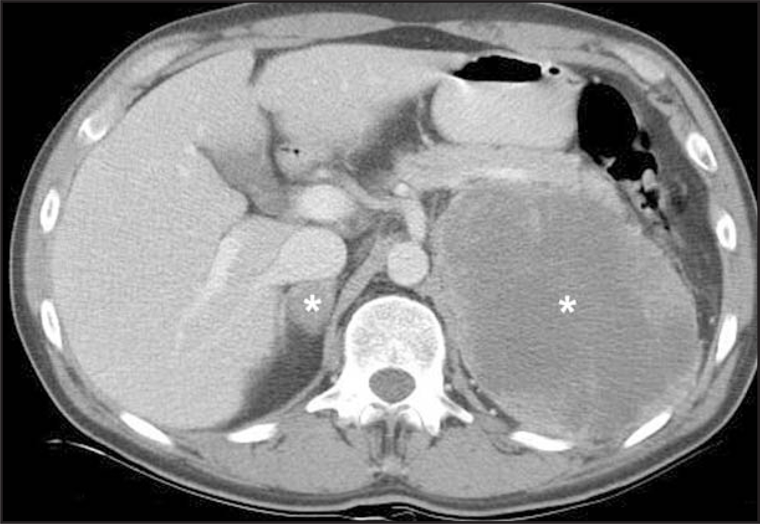FIGURE 14.
