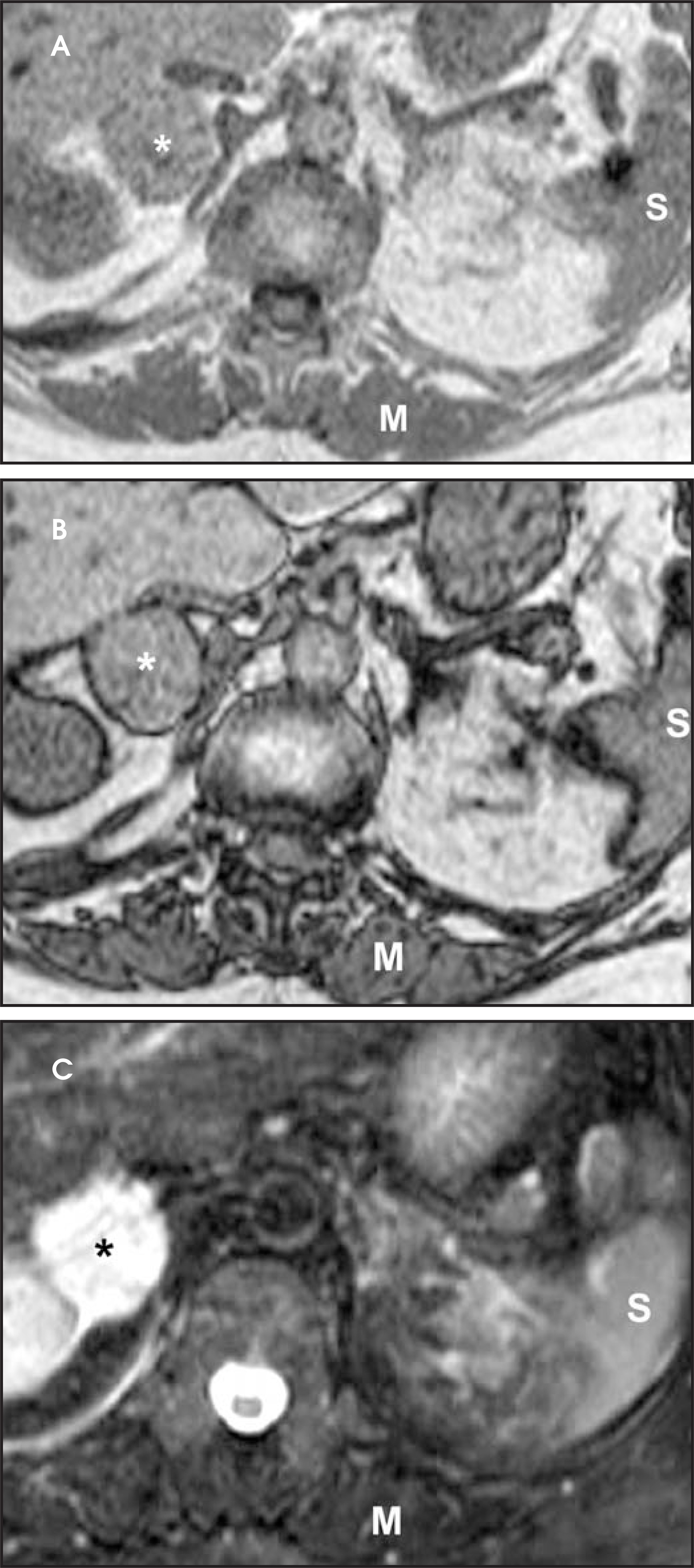 FIGURE 17.