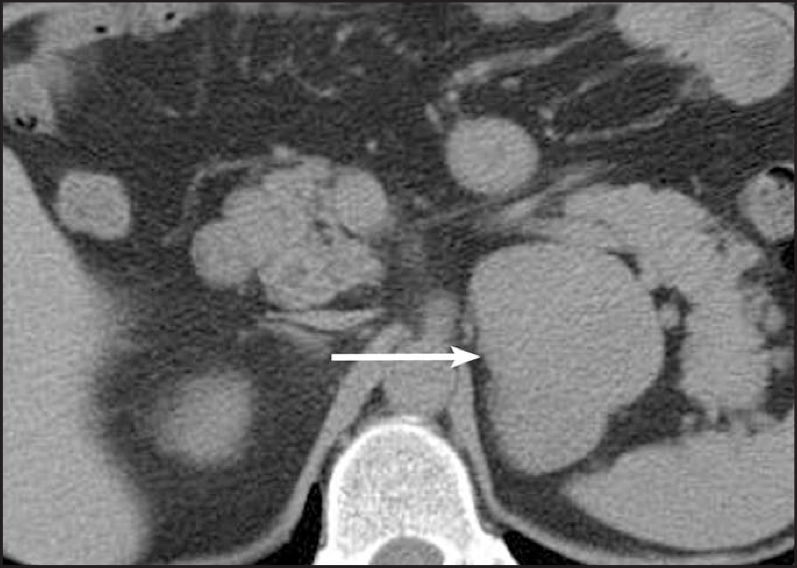 FIGURE 20.
