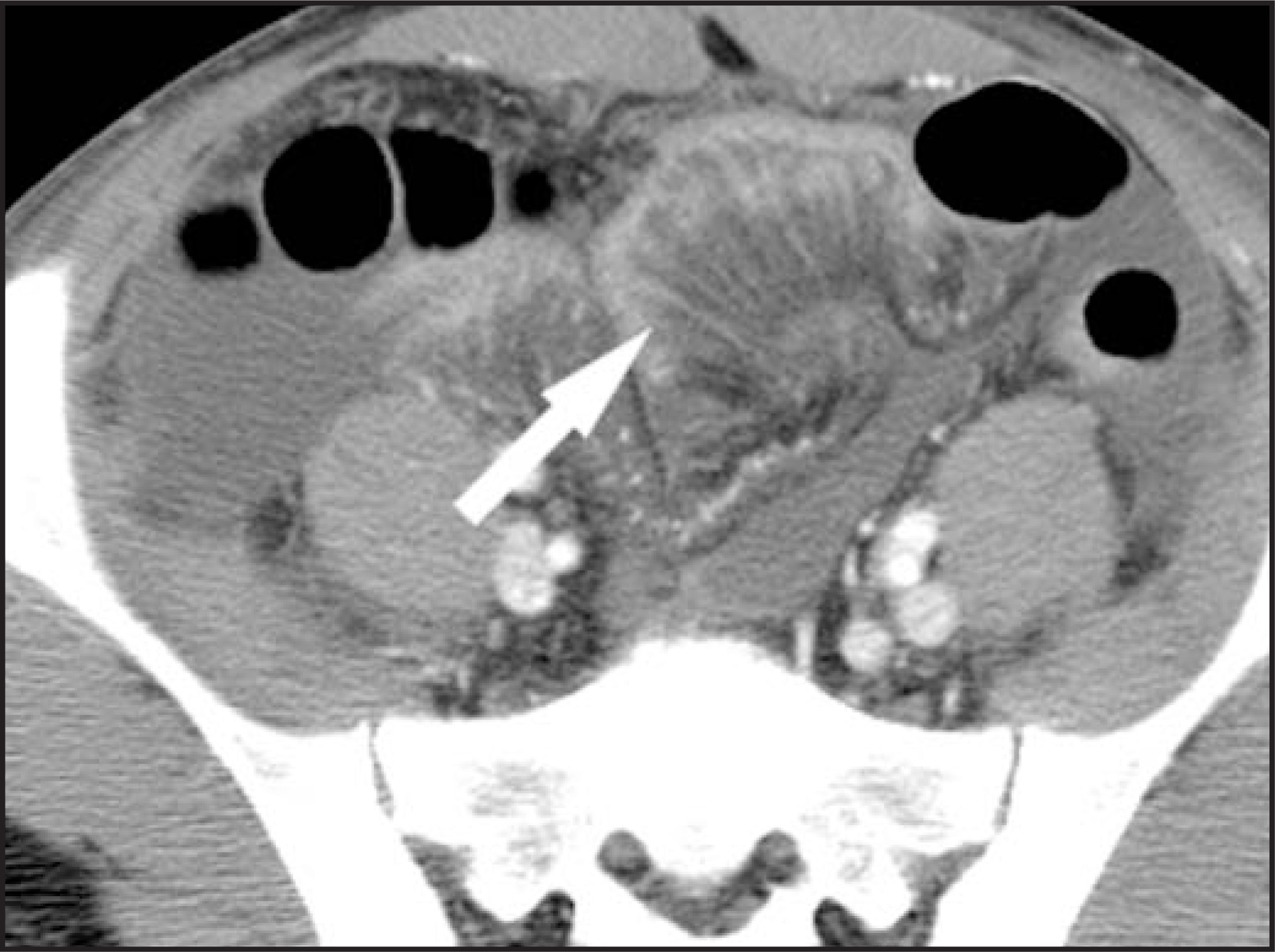 FIGURE 11.