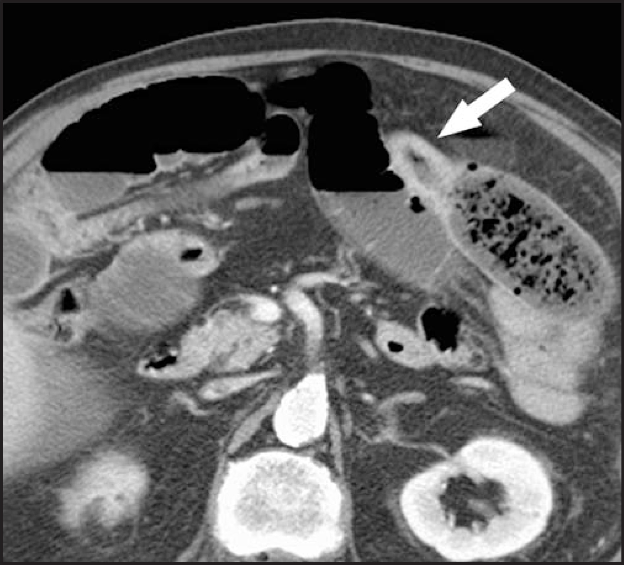 FIGURE 13.
