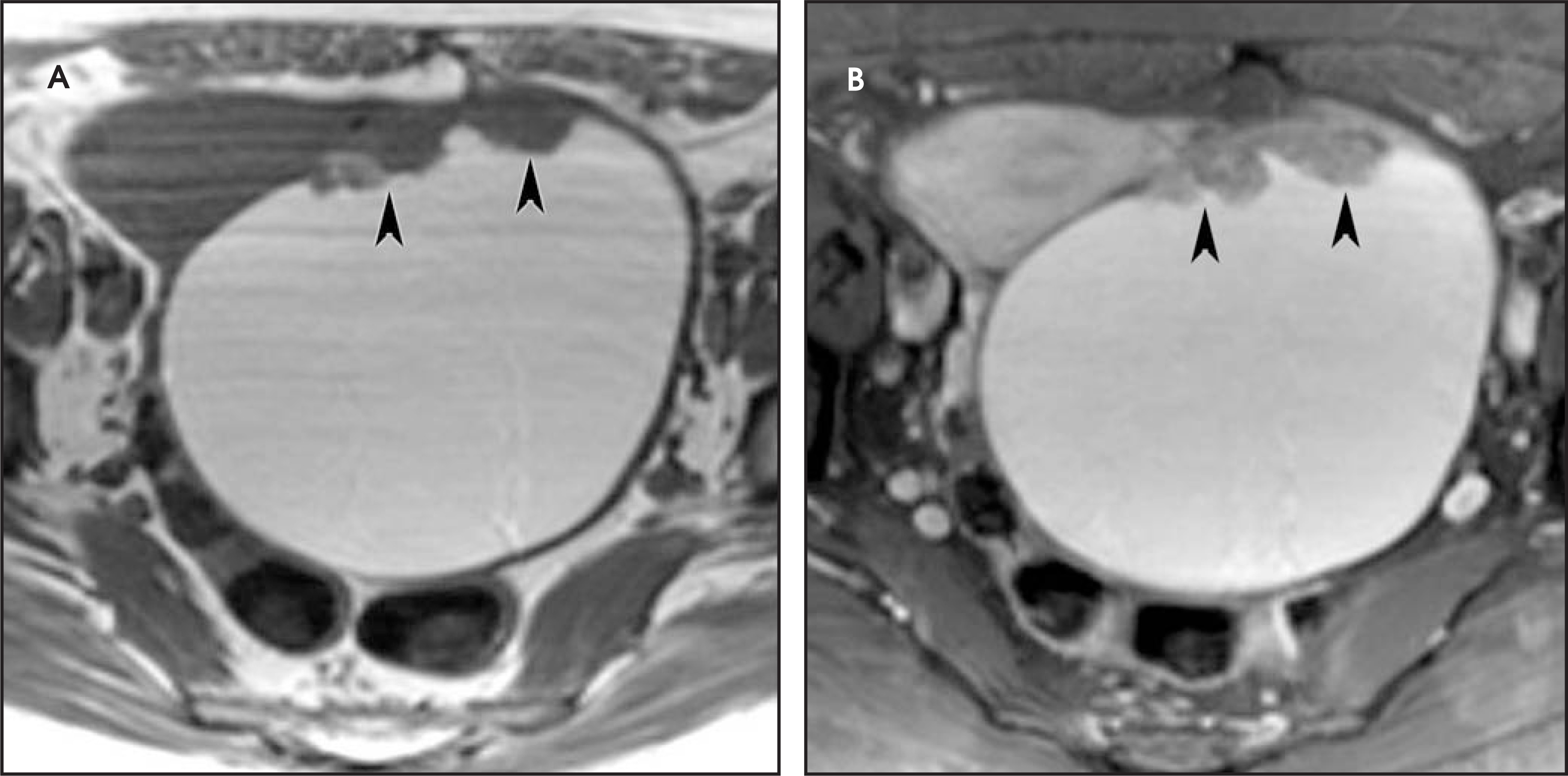 FIGURE 11.