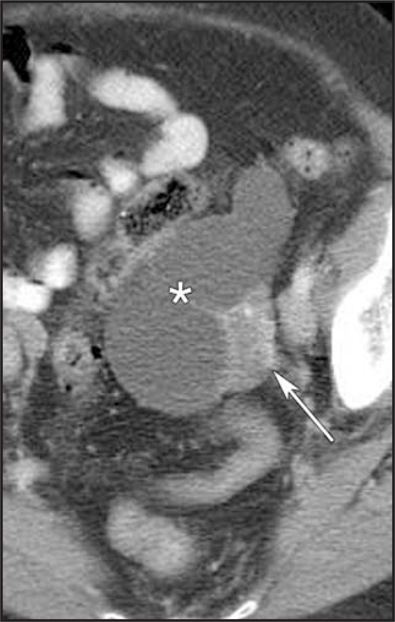FIGURE 13.