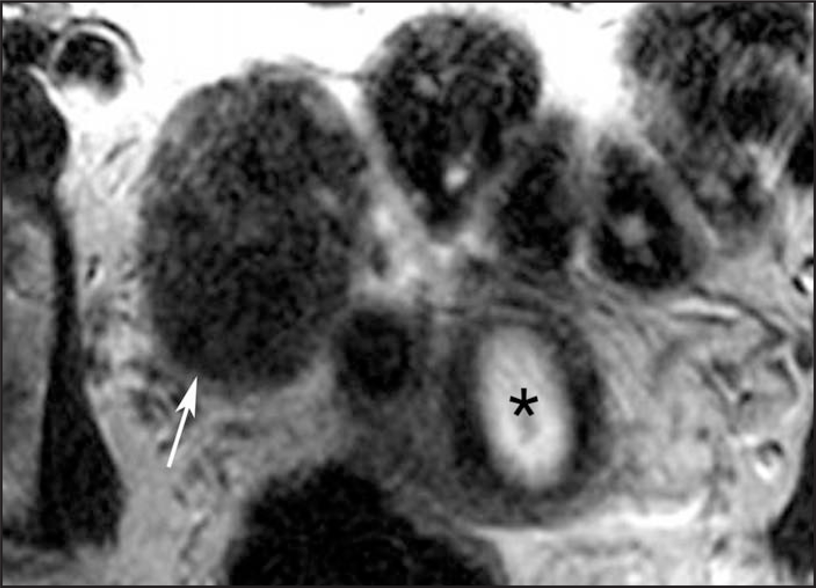 FIGURE 14.