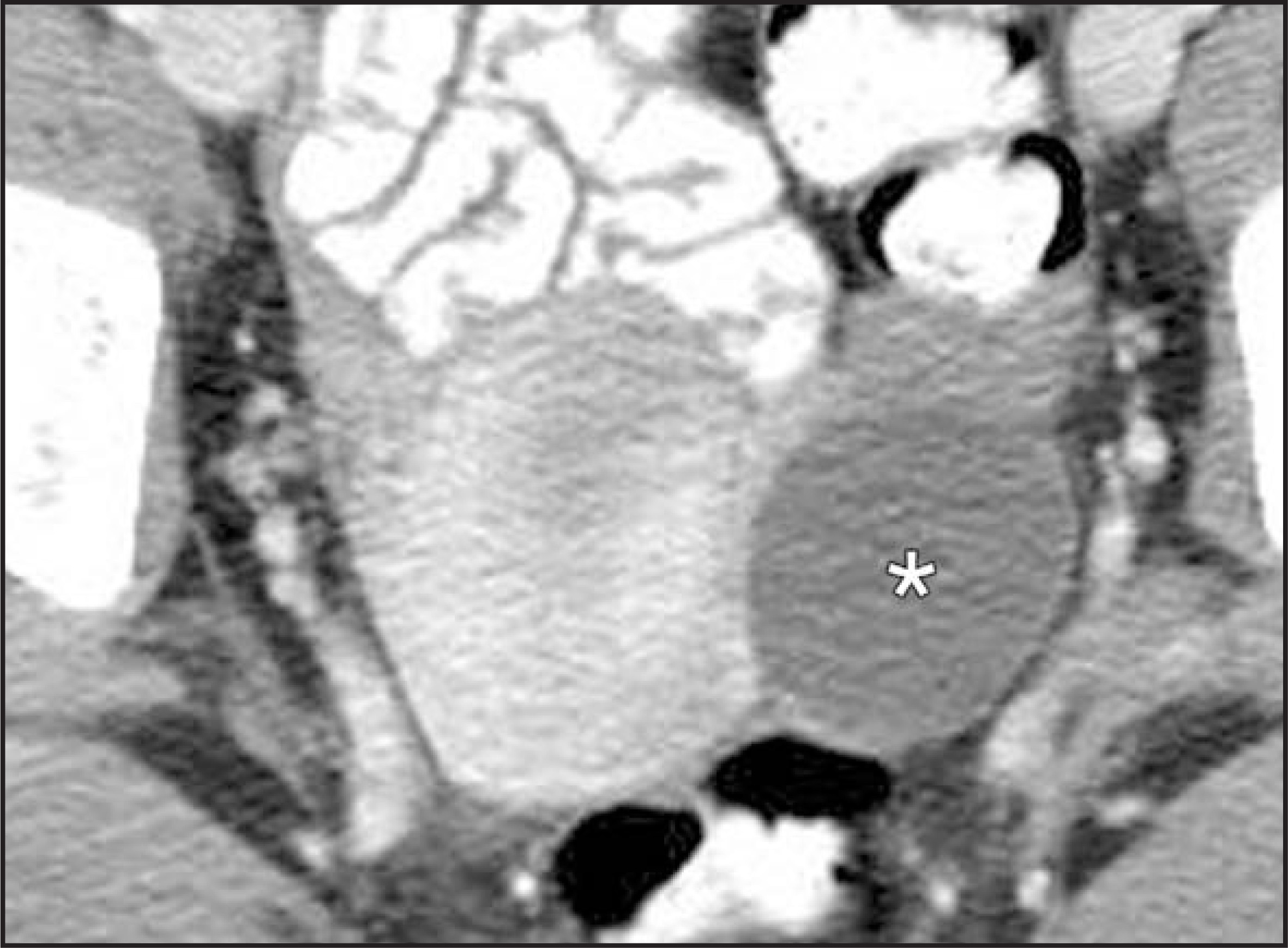 FIGURE 16.