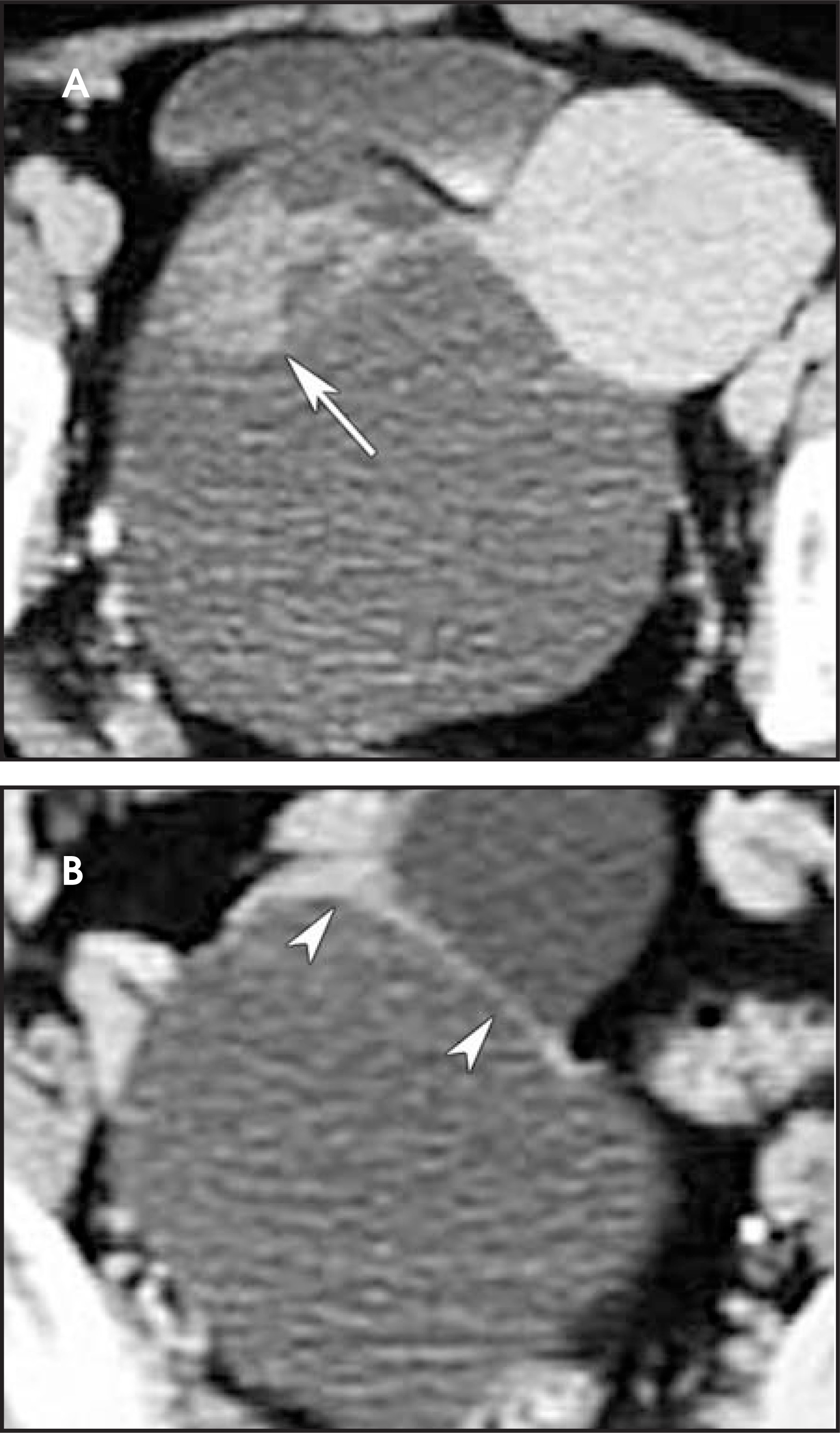 FIGURE 21.