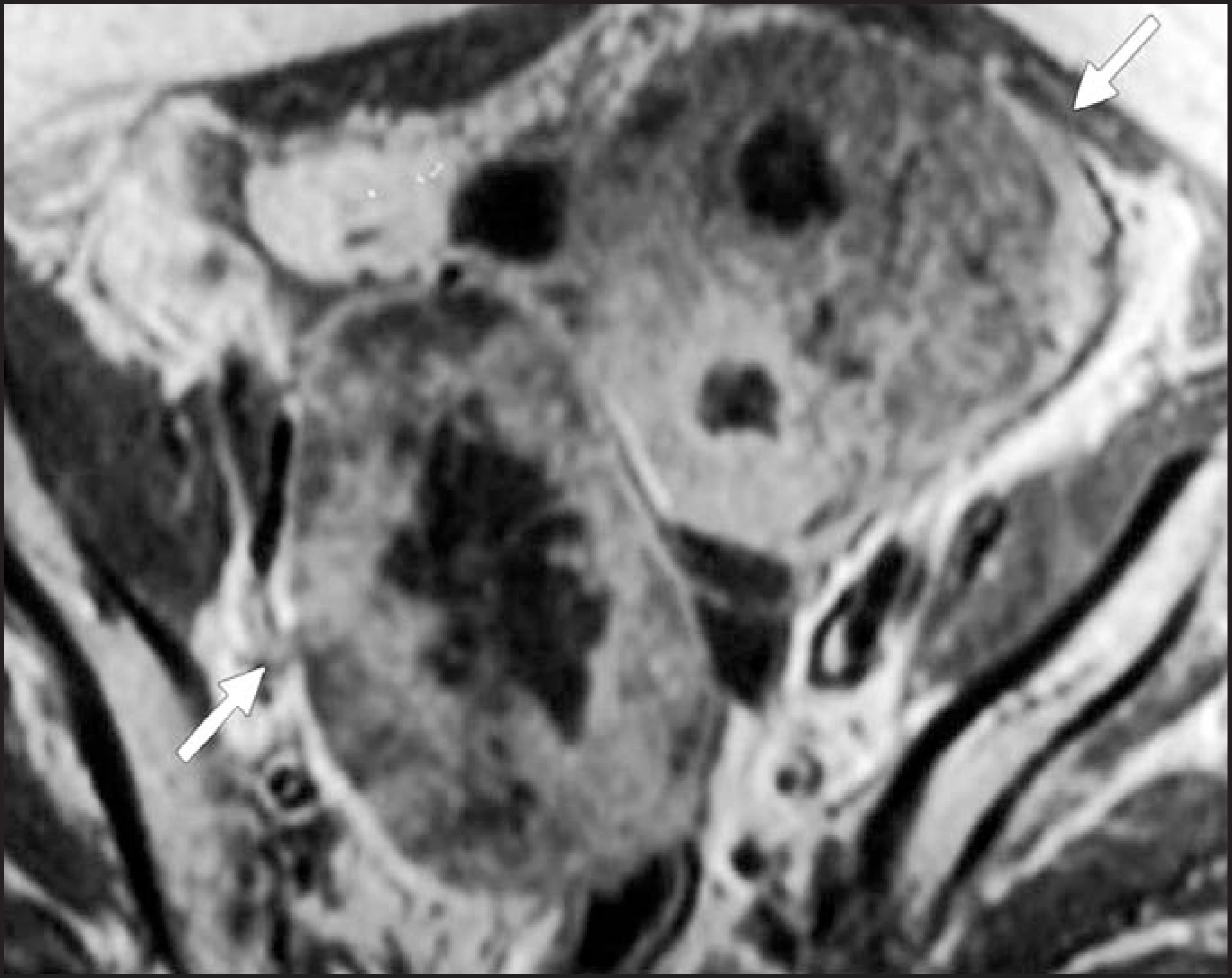 FIGURE 23.