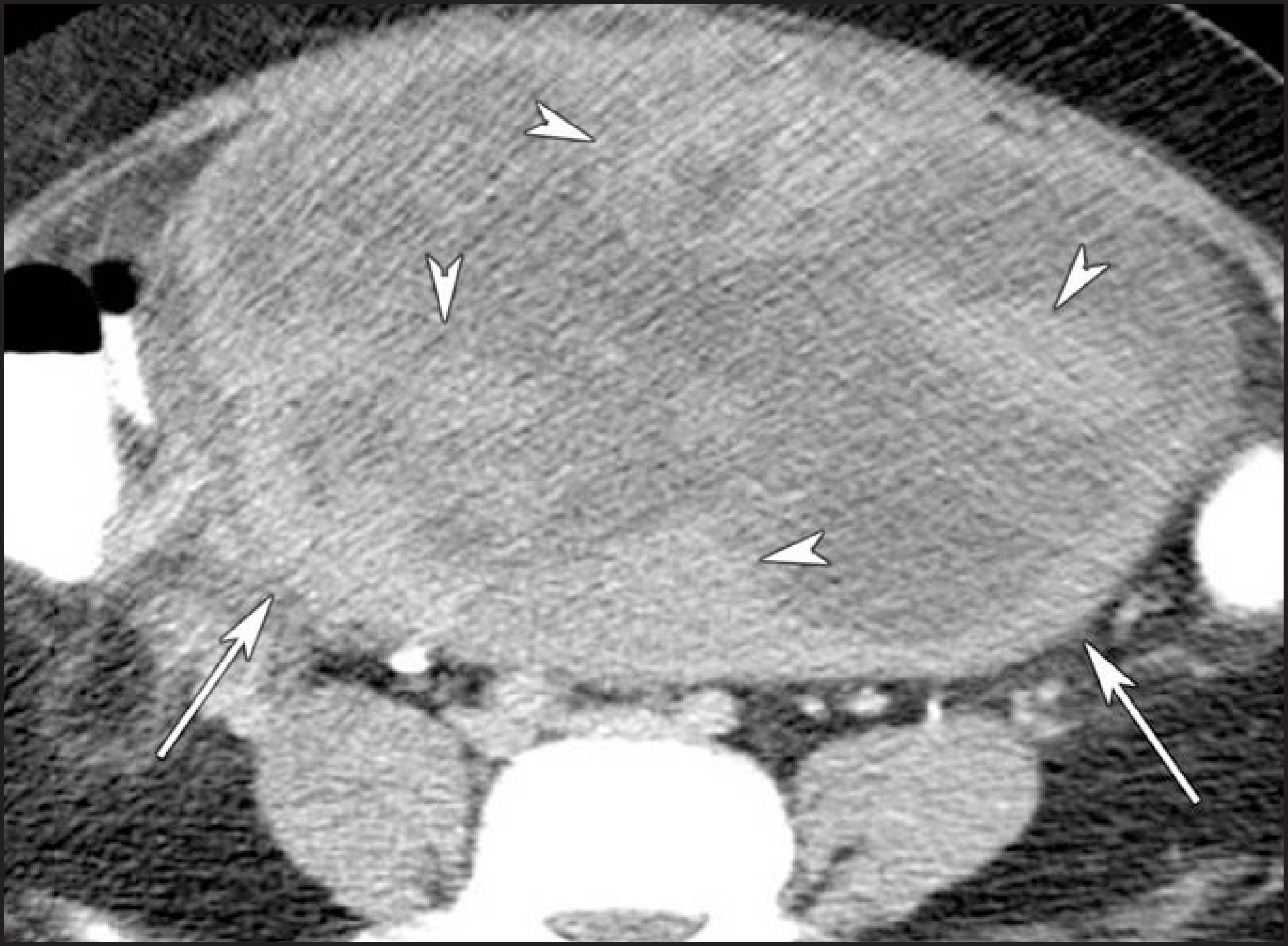 FIGURE 25.