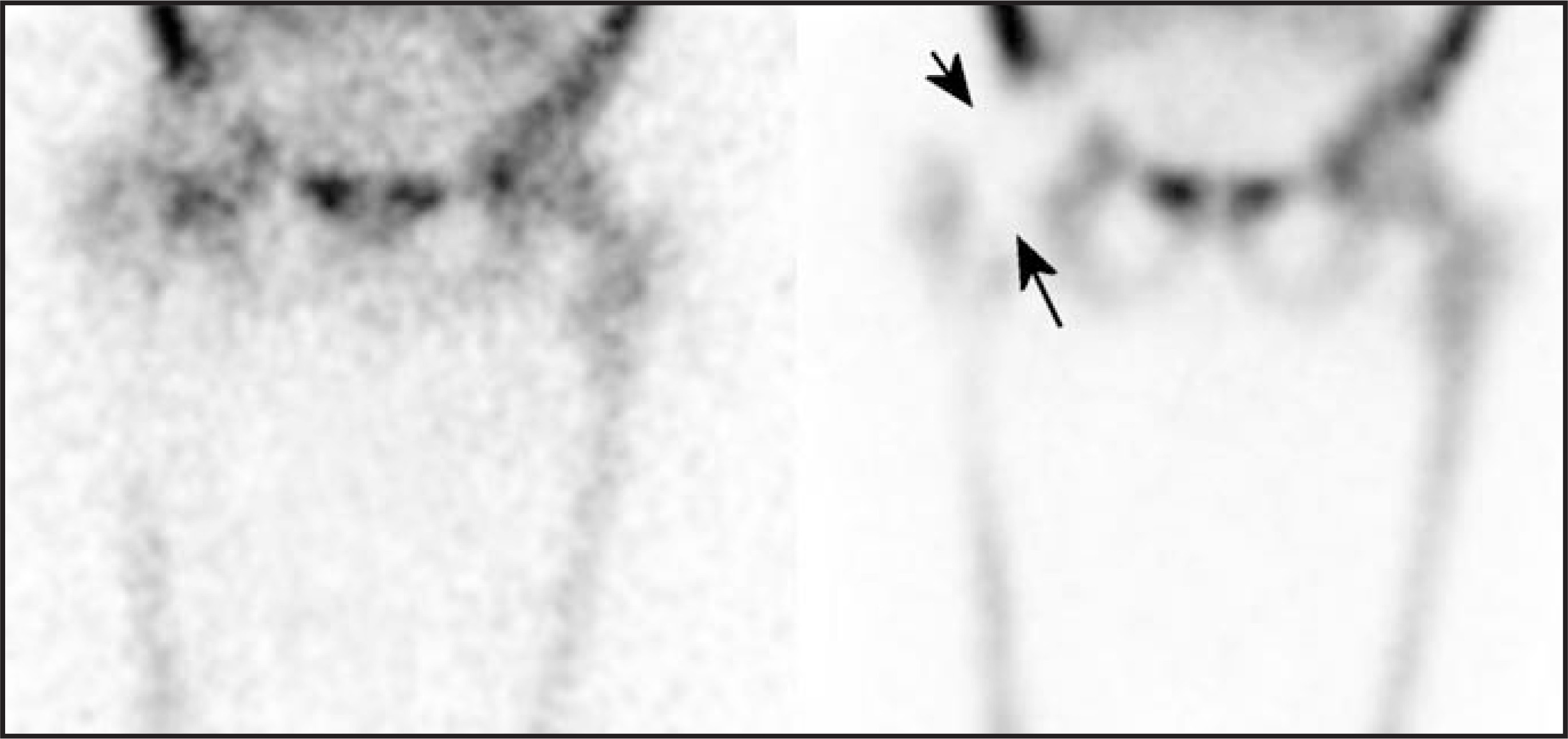 FIGURE 11.