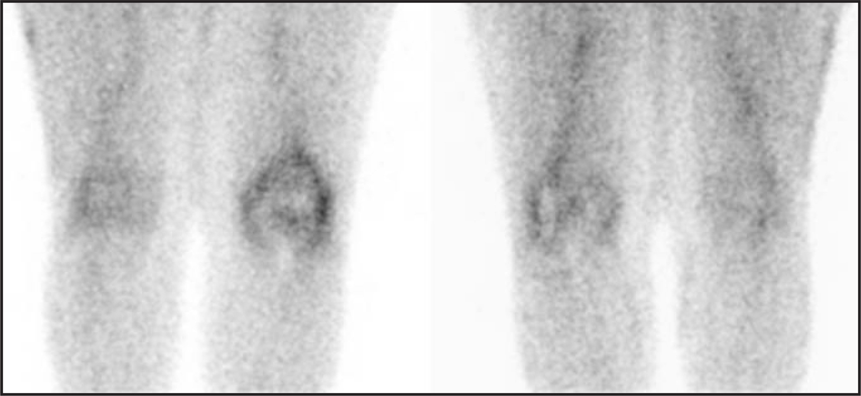 FIGURE 14.