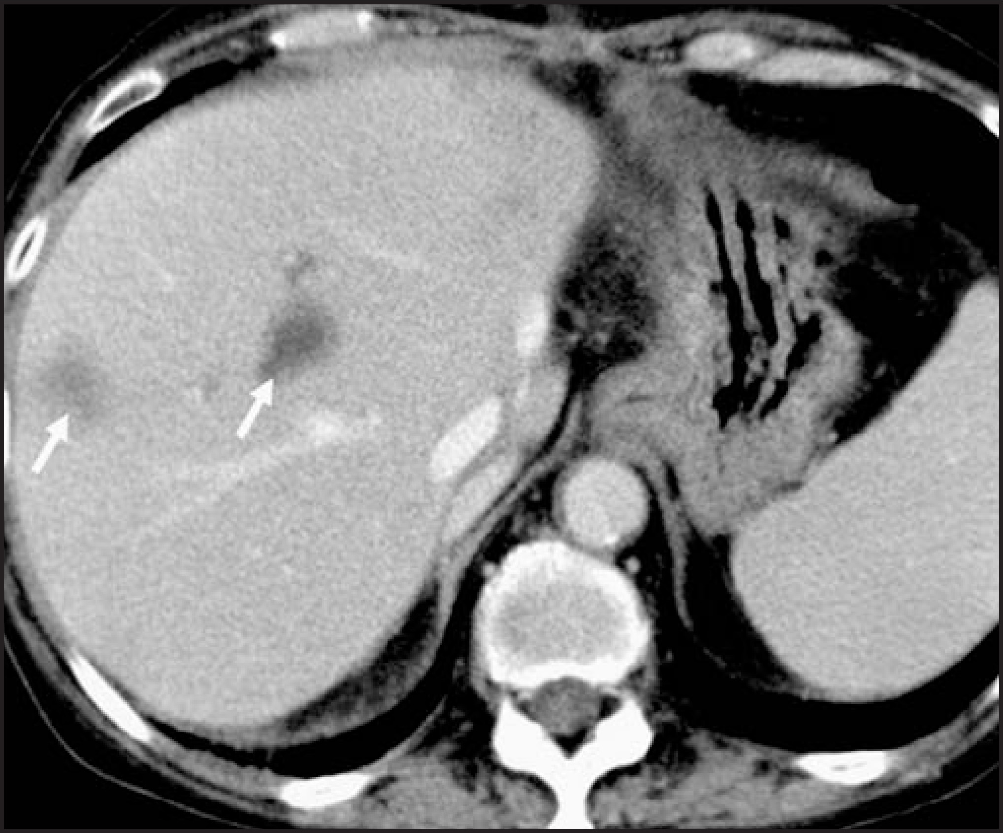 FIGURE 13.