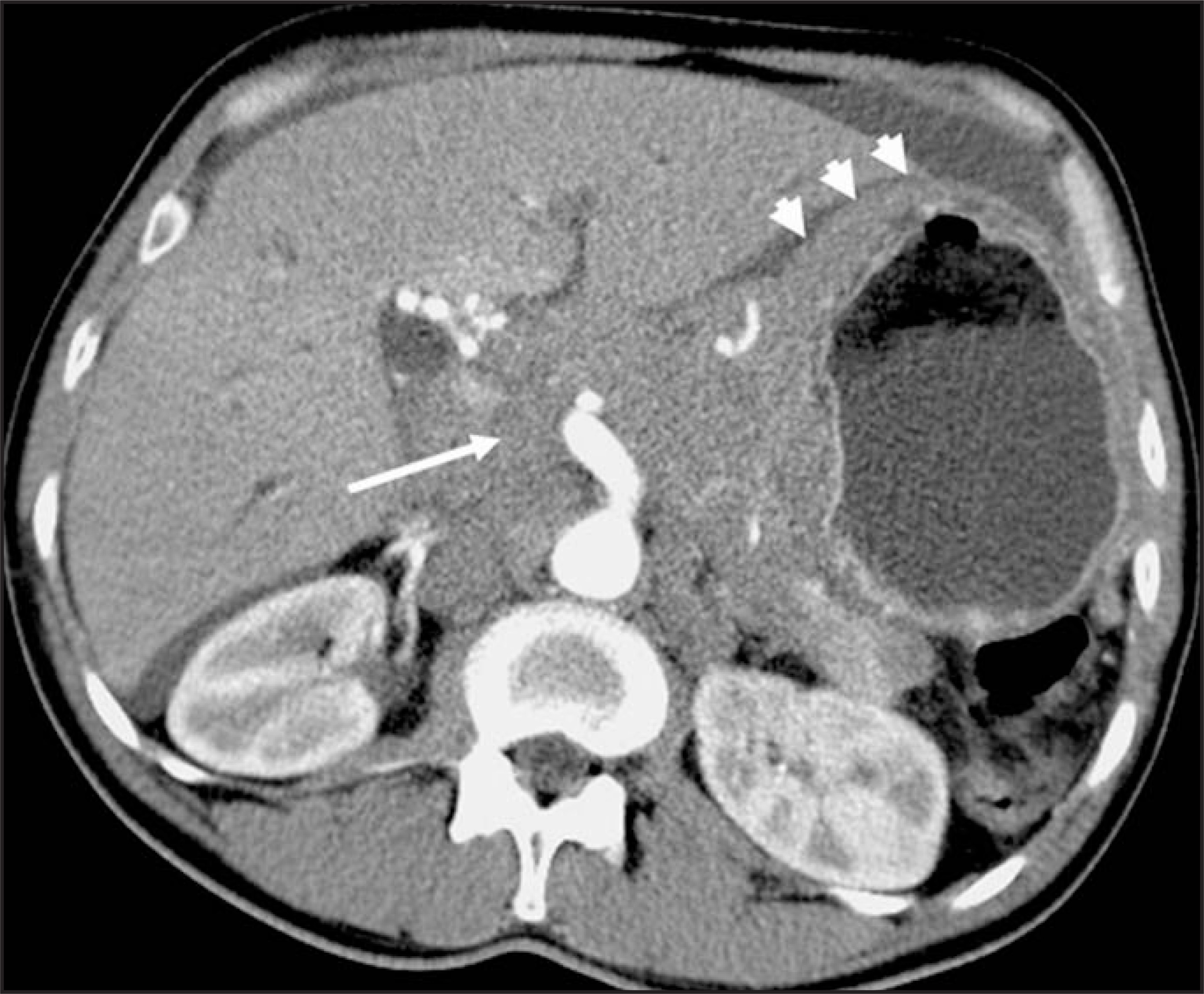 FIGURE 14.