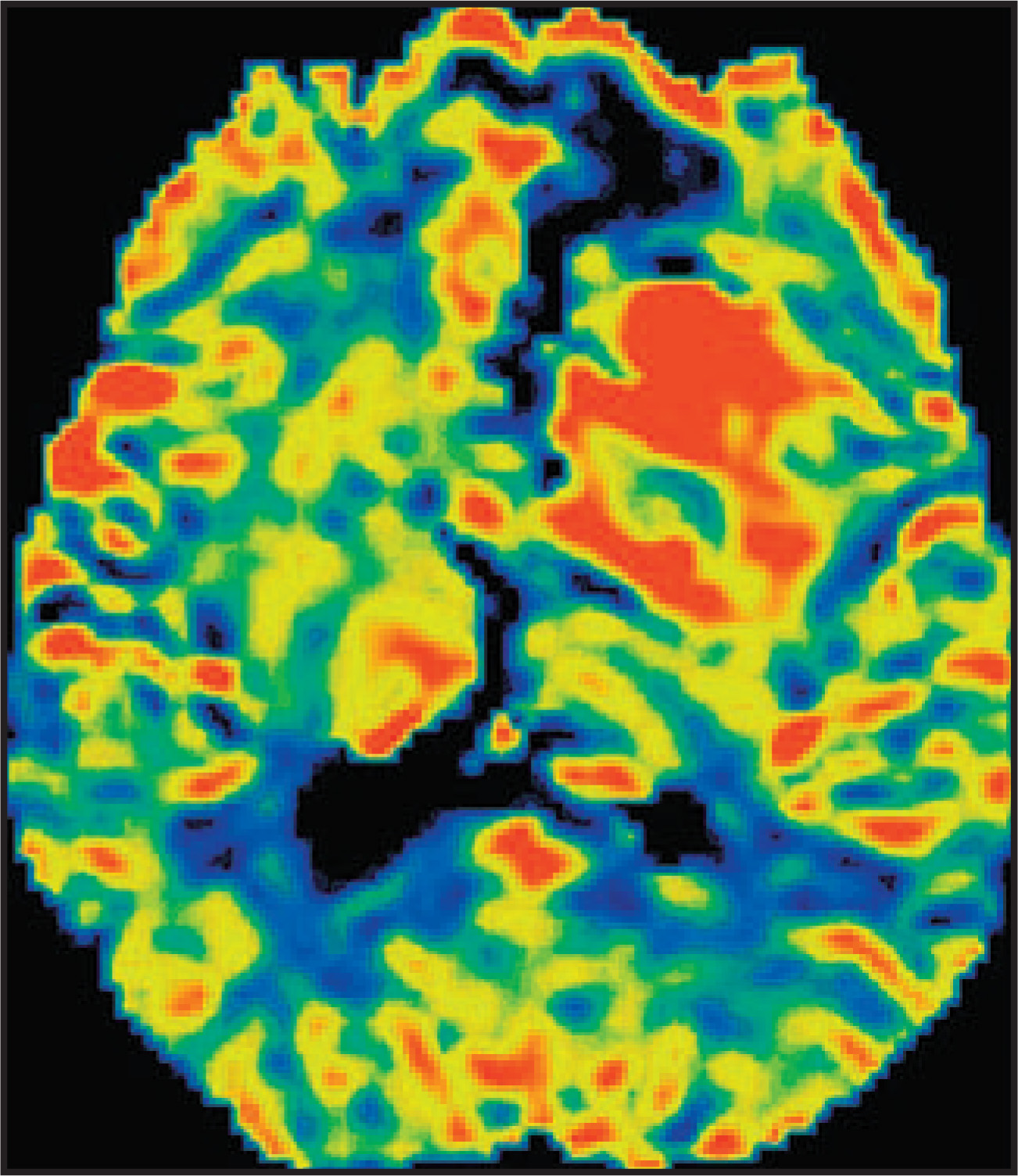 FIGURE 11.