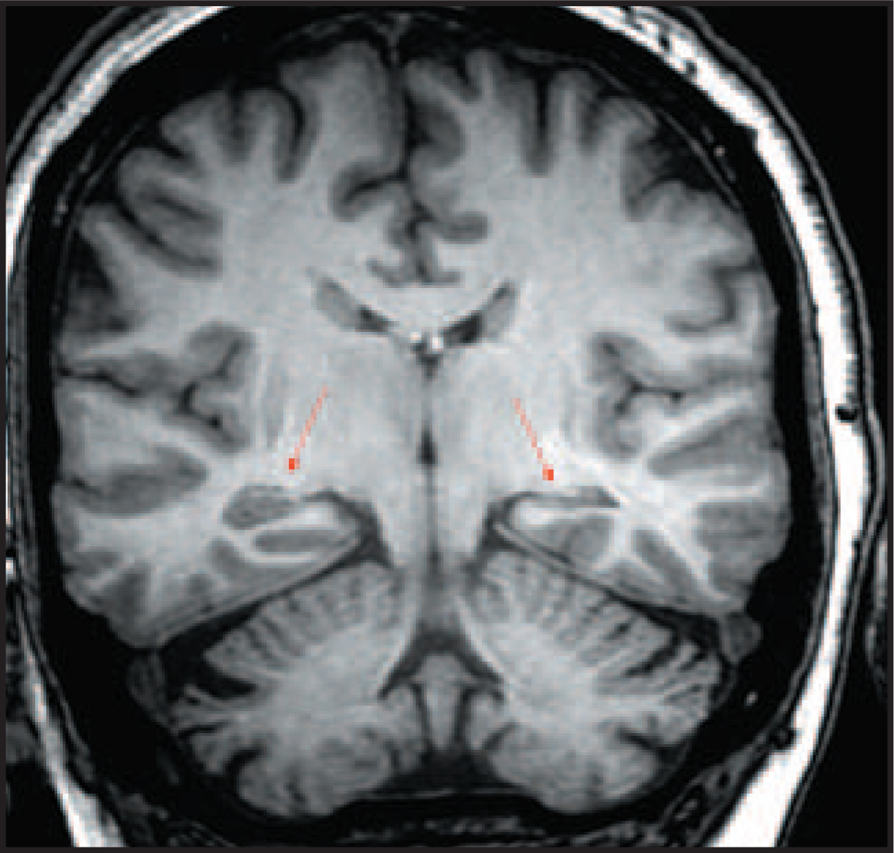 FIGURE 13.