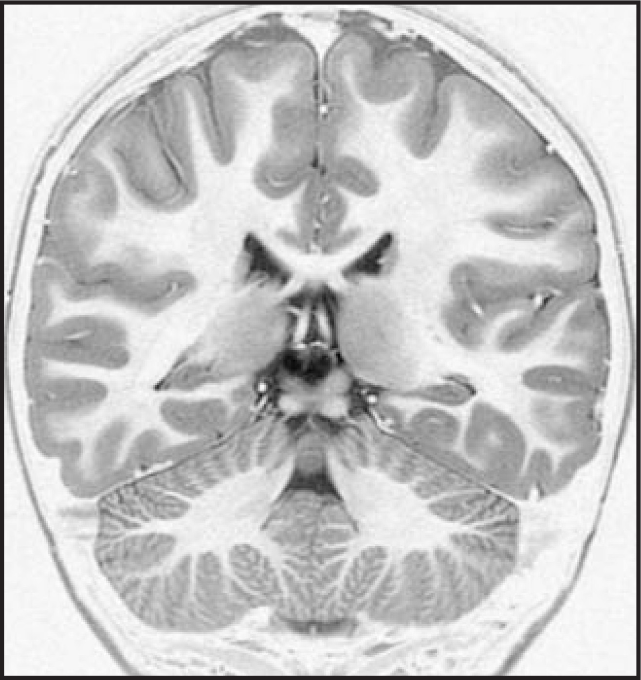 FIGURE 14.