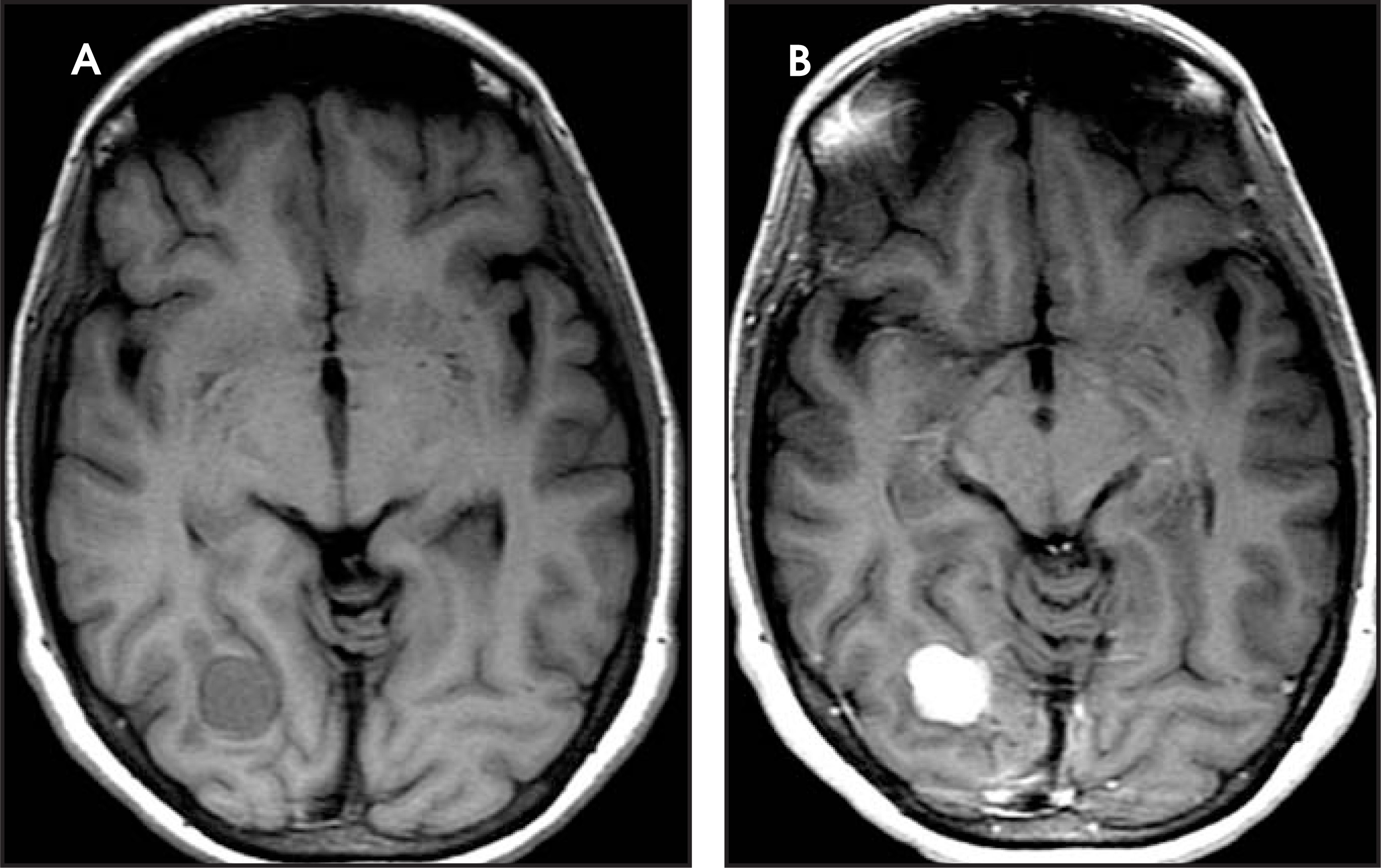 FIGURE 17.