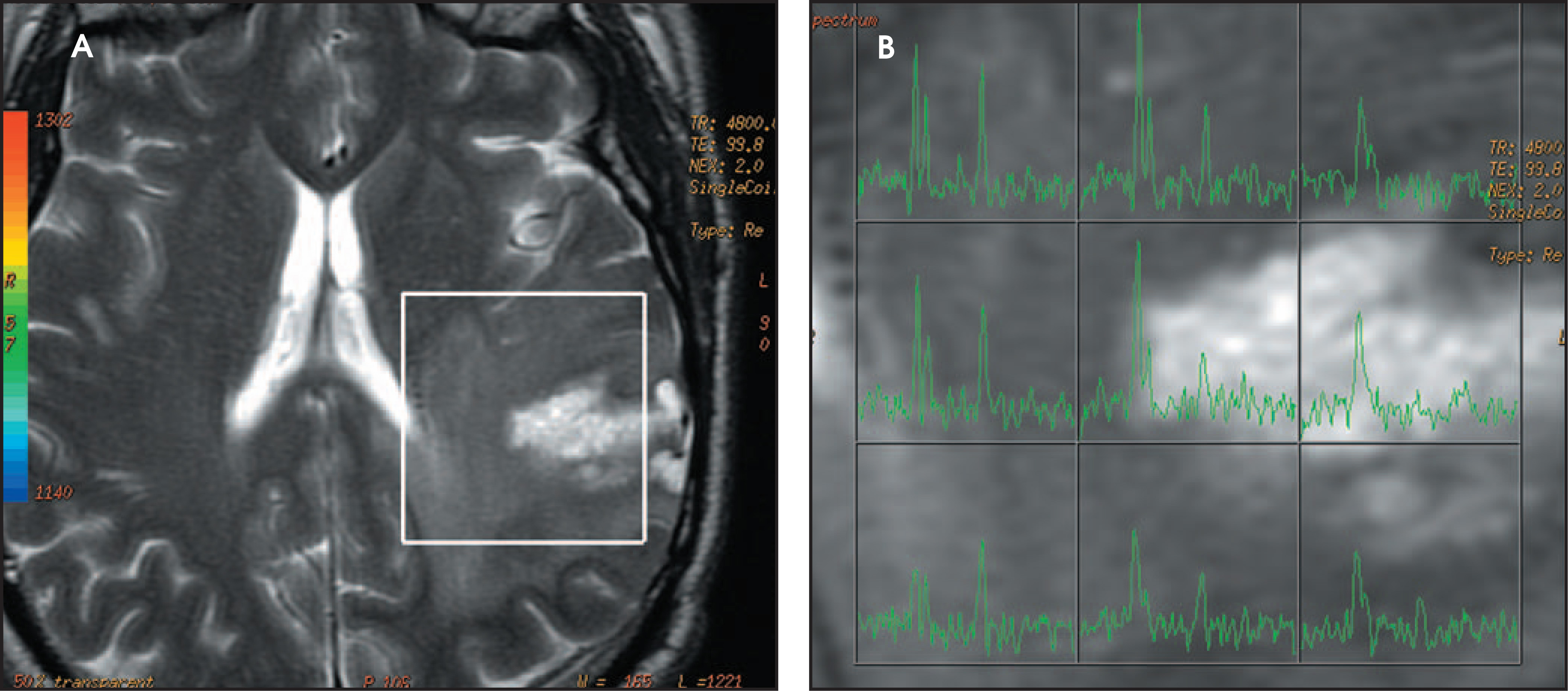 FIGURE 23.