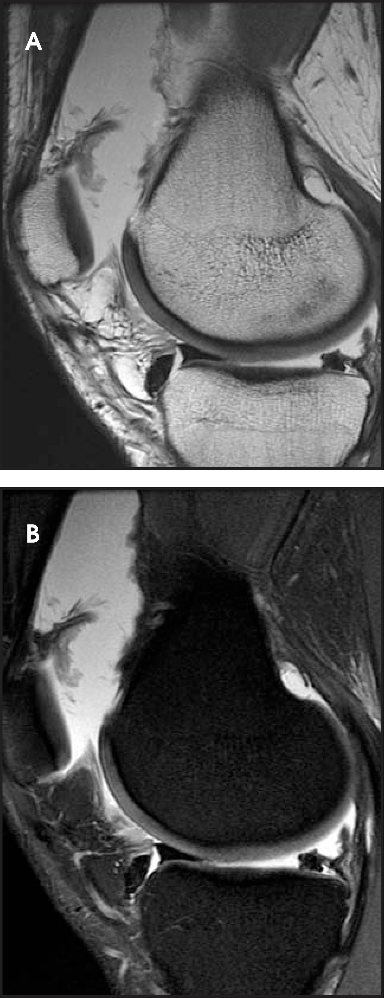 FIGURE 30.