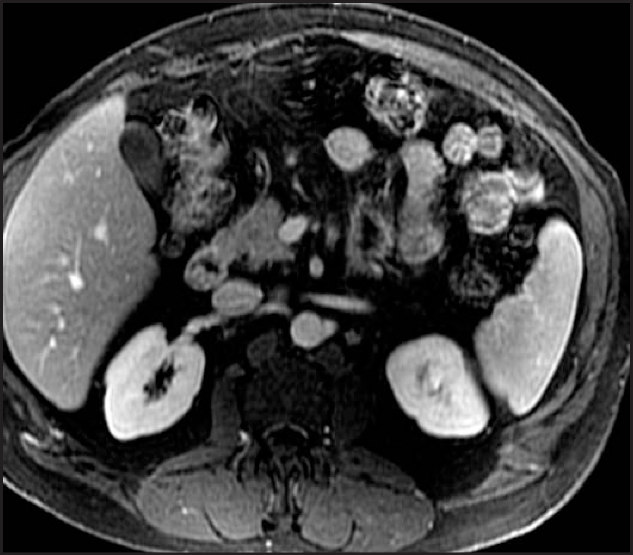 FIGURE 33.