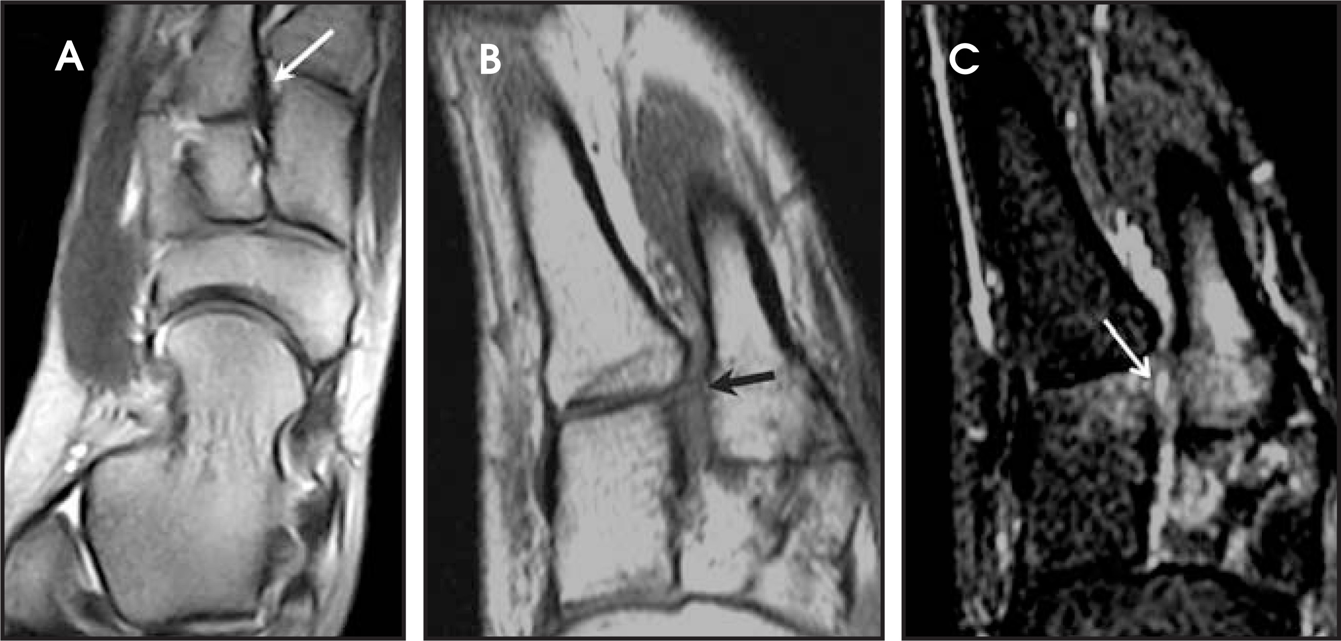 FIGURE 11.