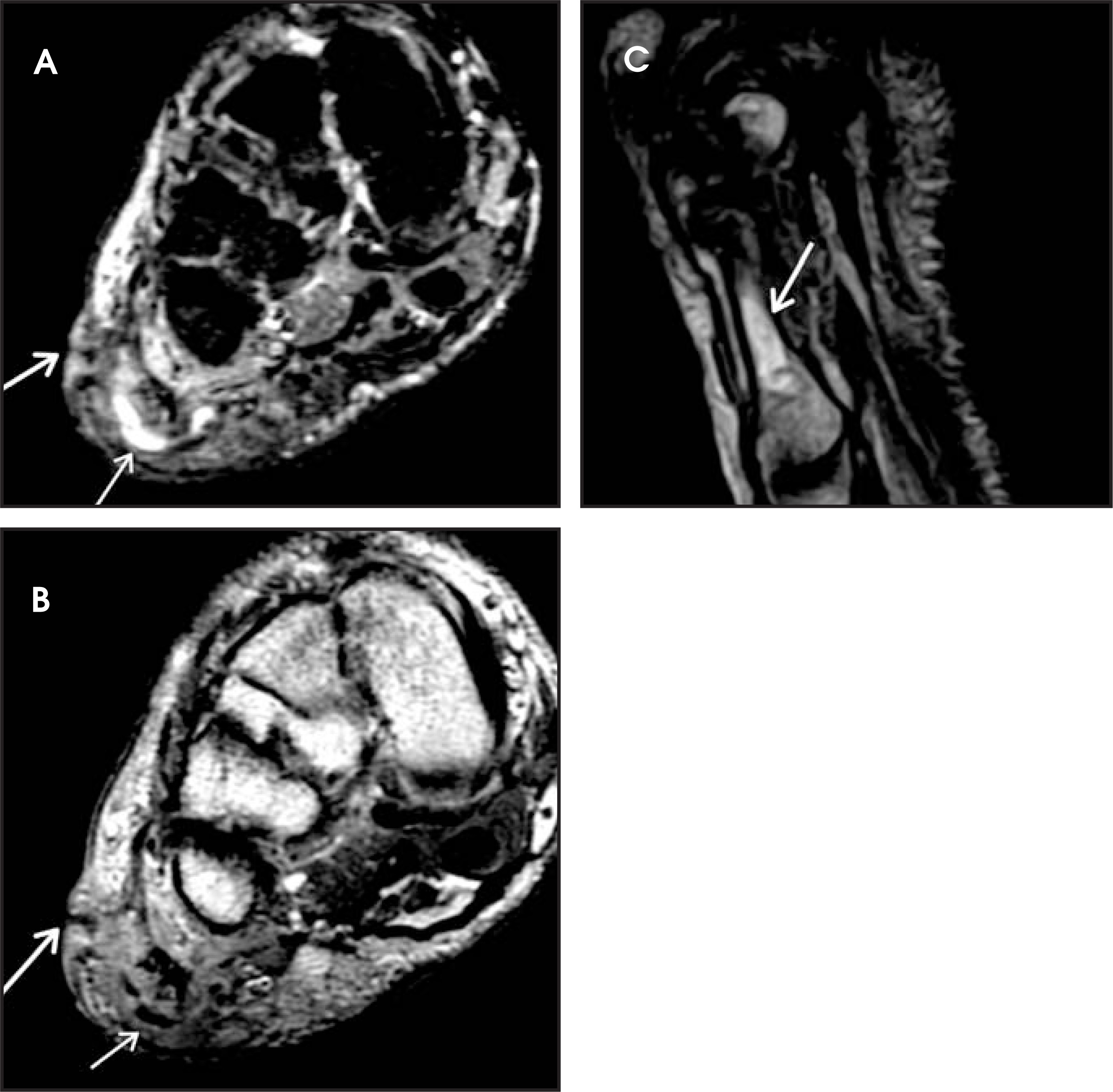 FIGURE 14.