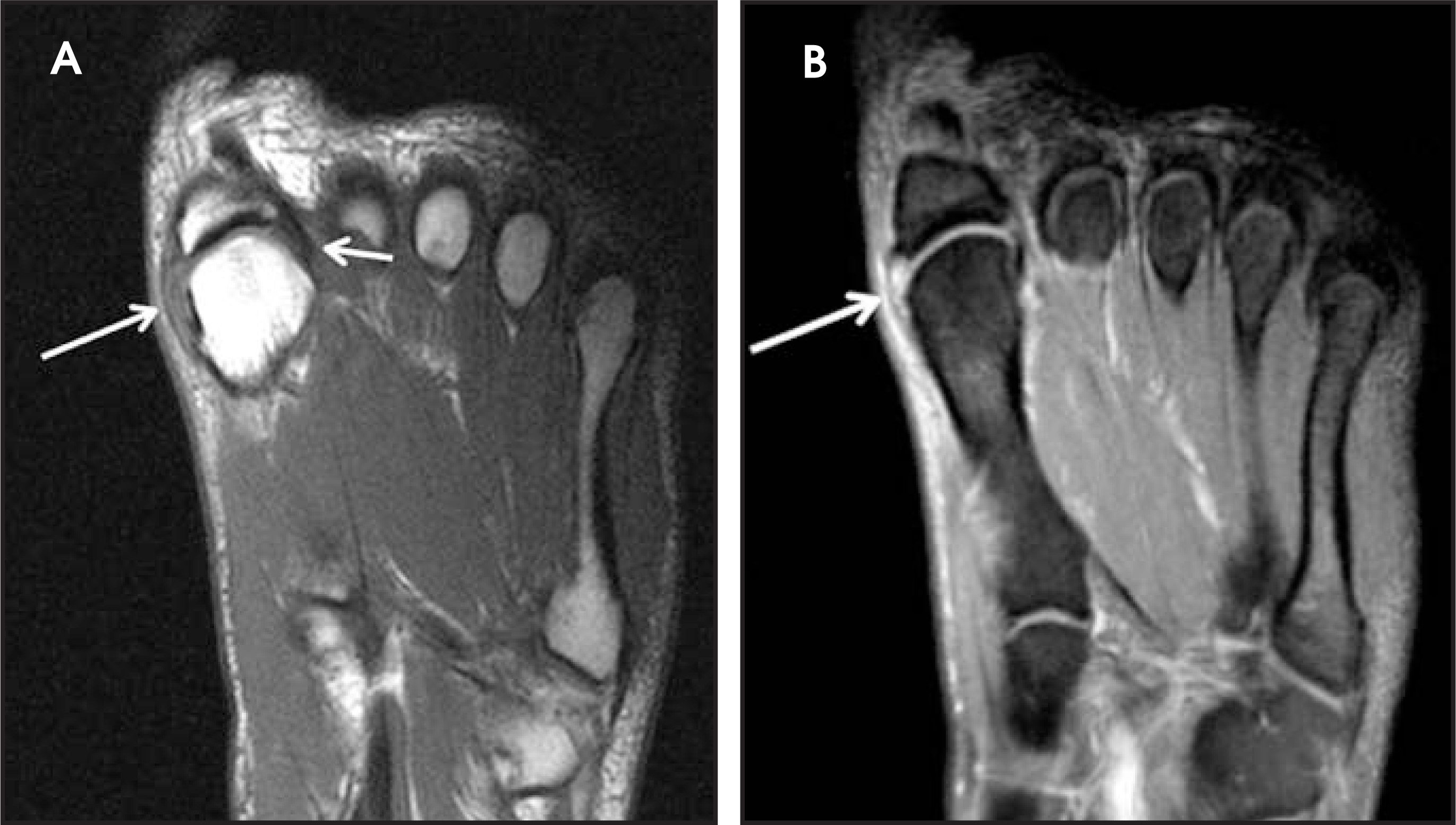 FIGURE 16.
