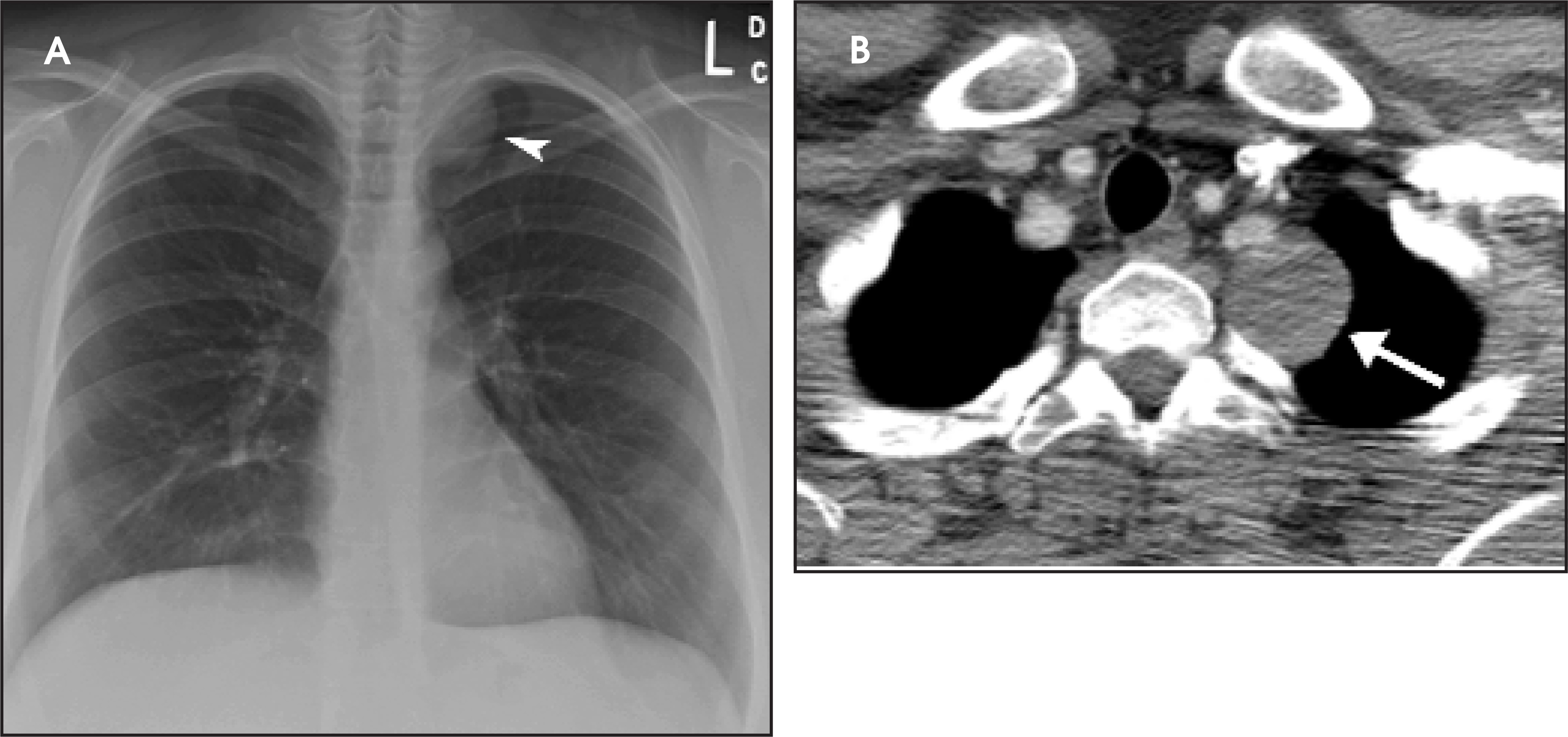 FIGURE 11.