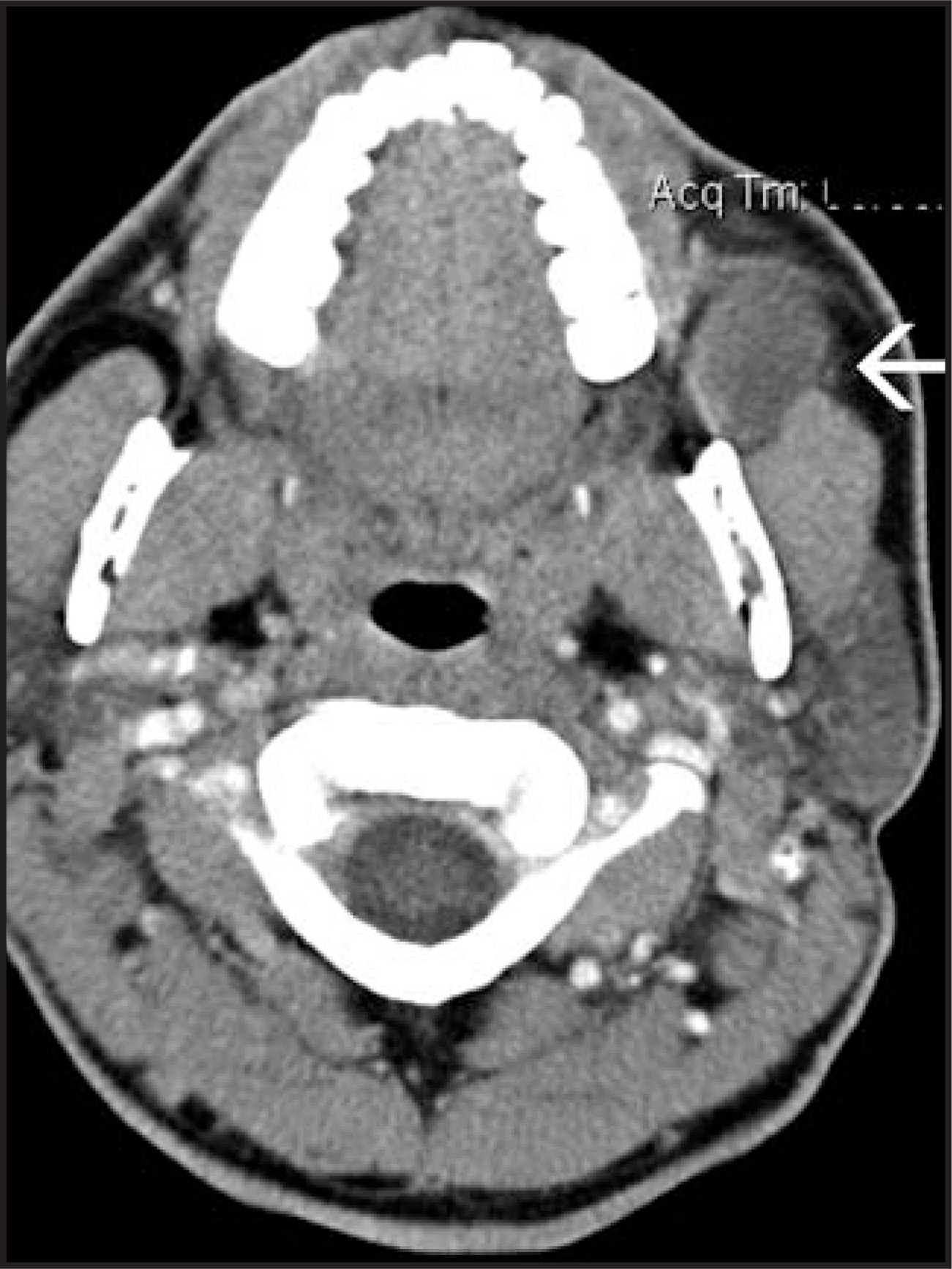 FIGURE 10.
