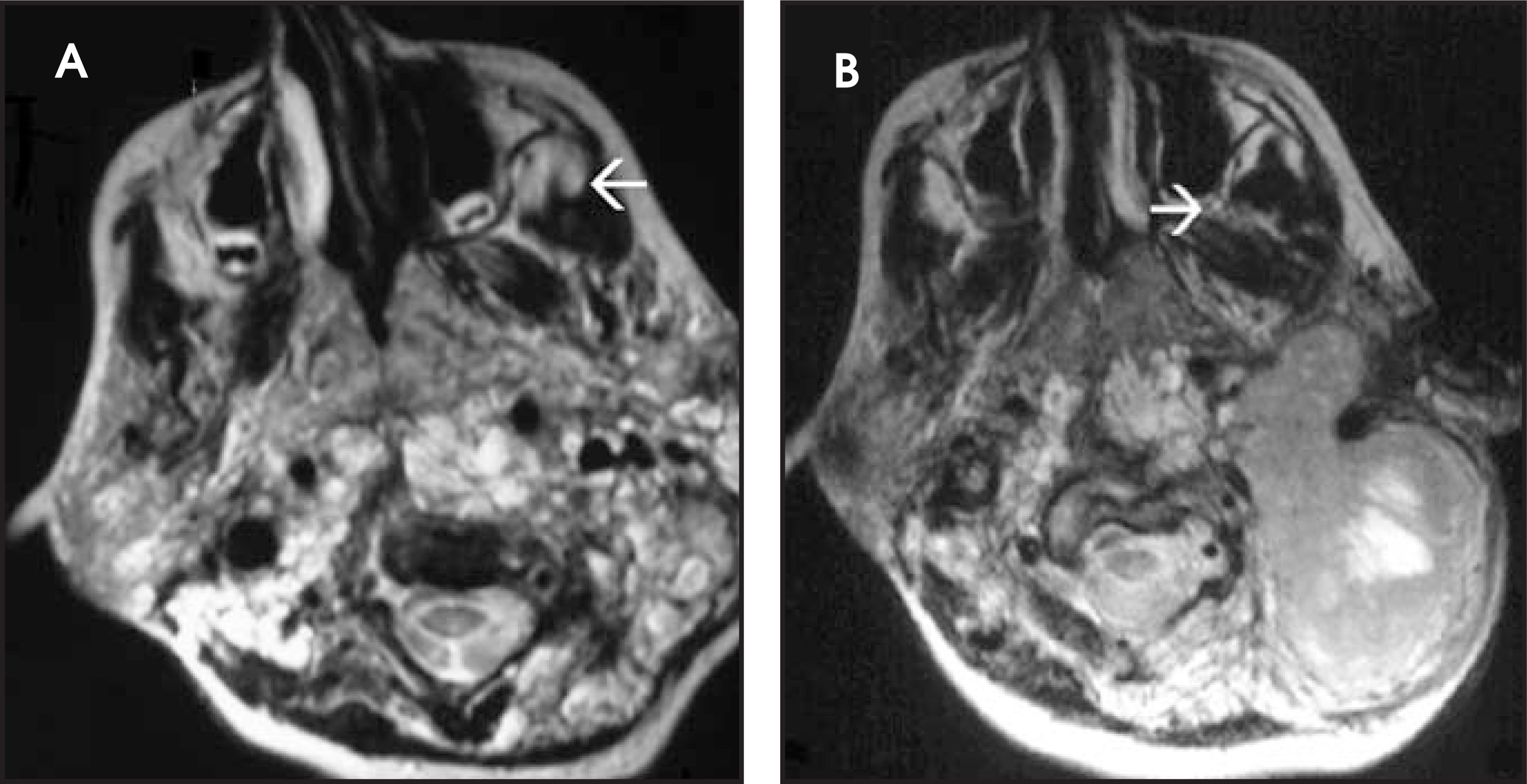 FIGURE 11.
