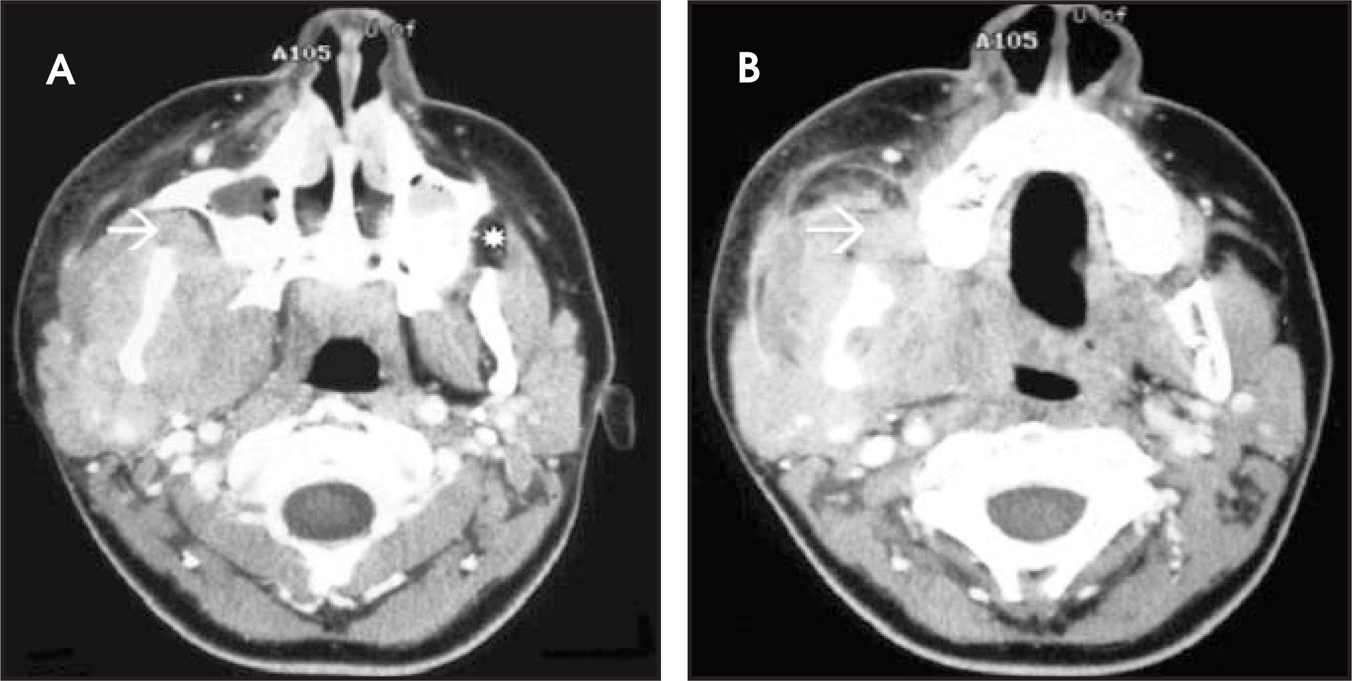 FIGURE 13.