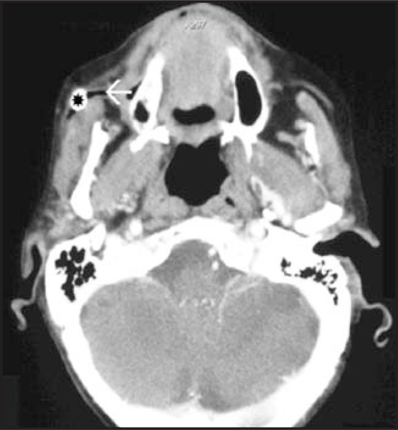 FIGURE 14.