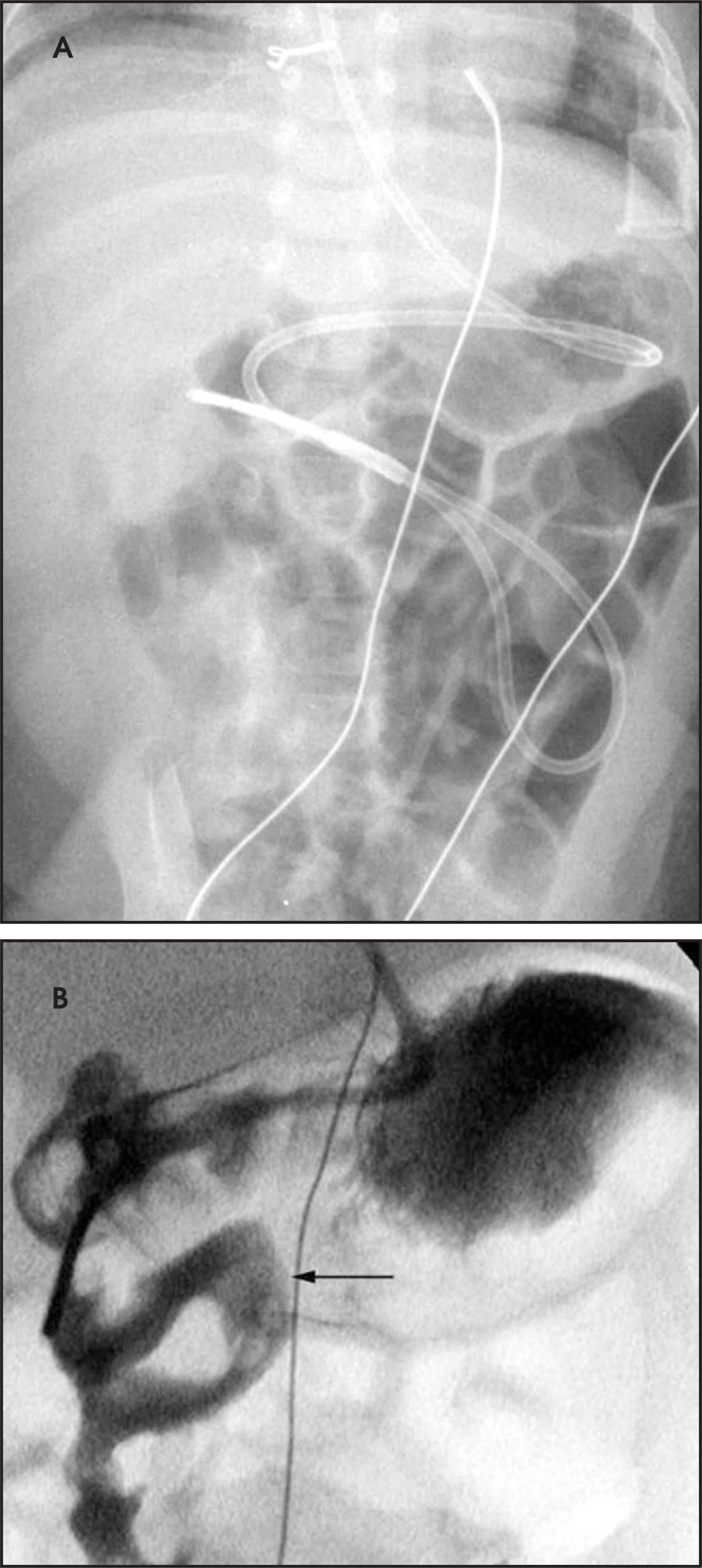 FIGURE 11.
