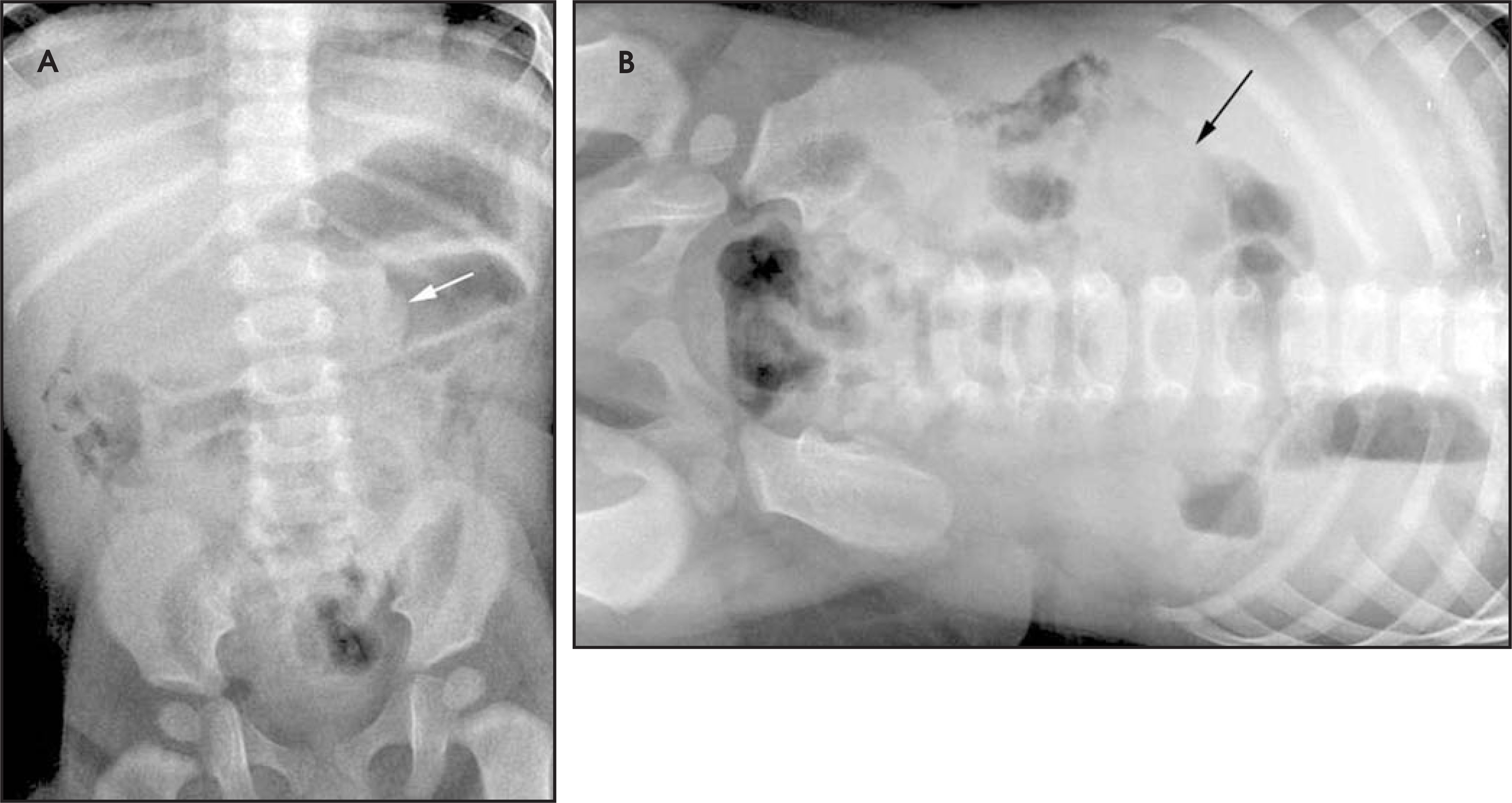 FIGURE 13.