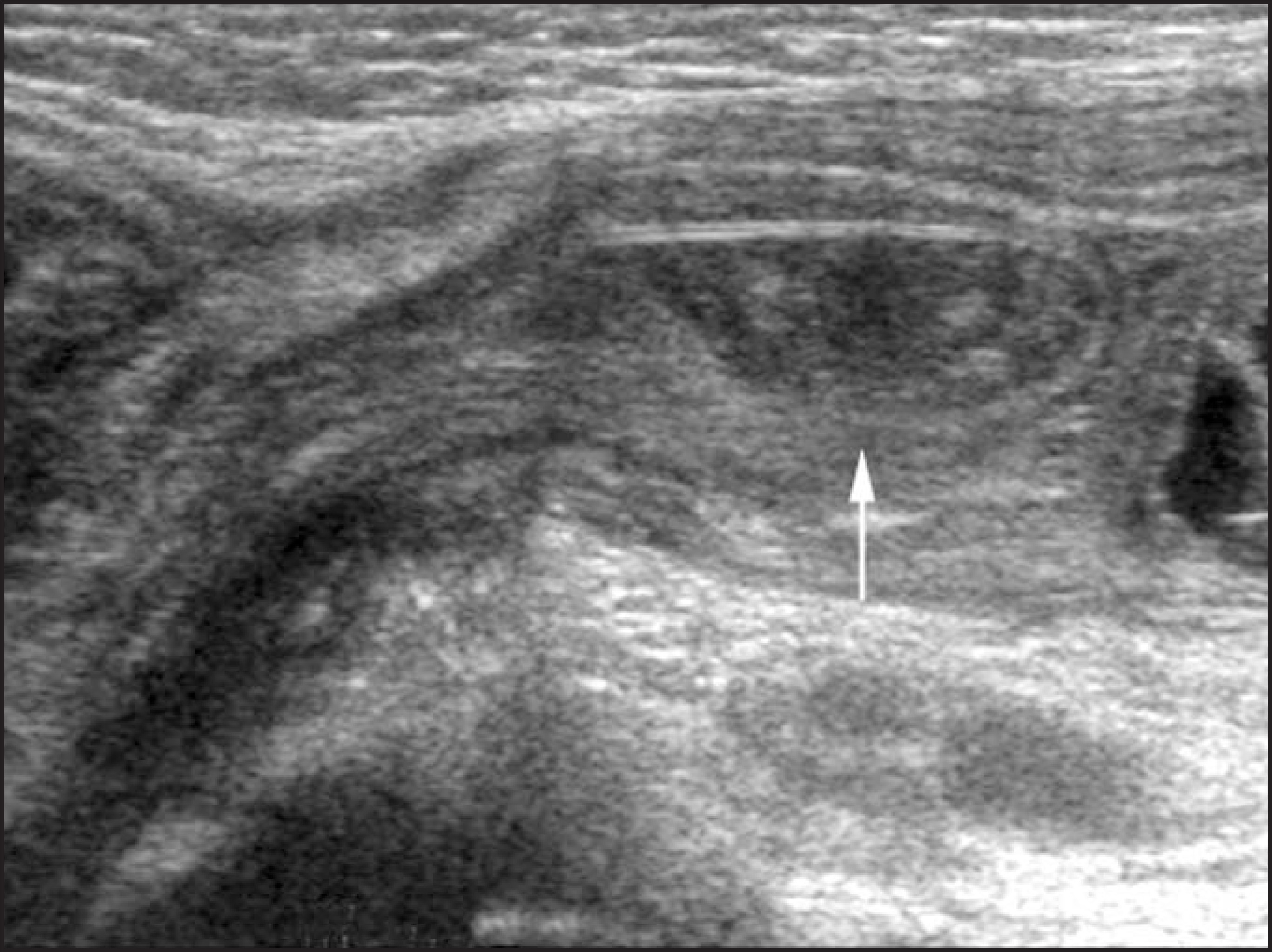 FIGURE 16.